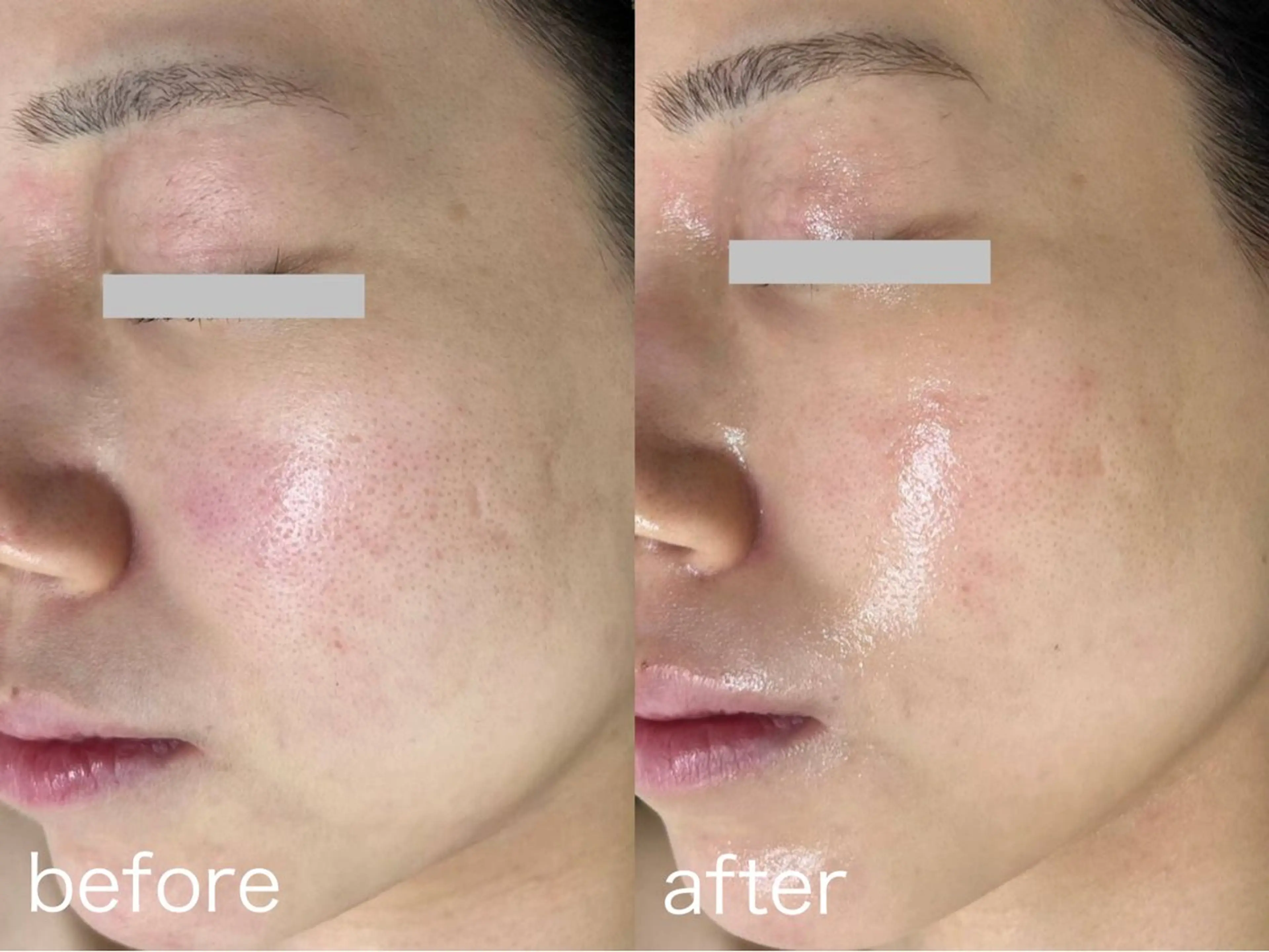 エステ 韓国美肌/肌質改善 【天神】のエステ・リラクイメージ