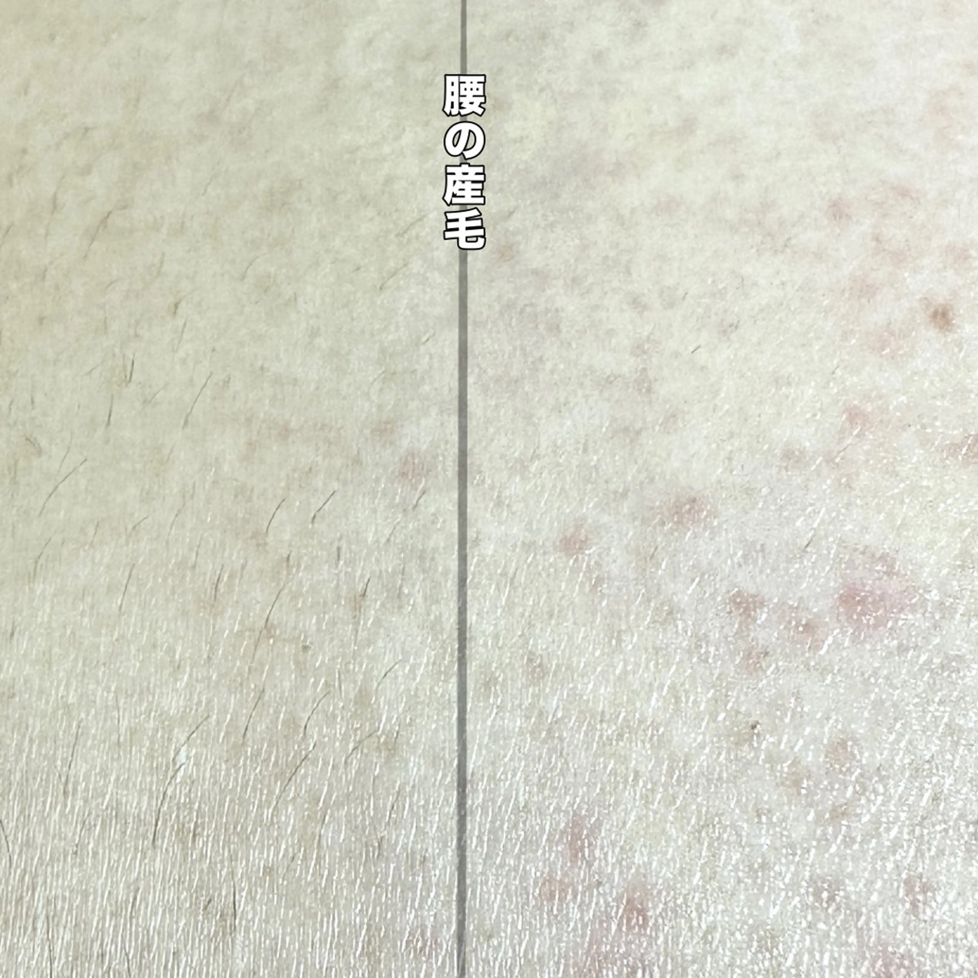 Hitomi シュガーリング豊橋のその他イメージ