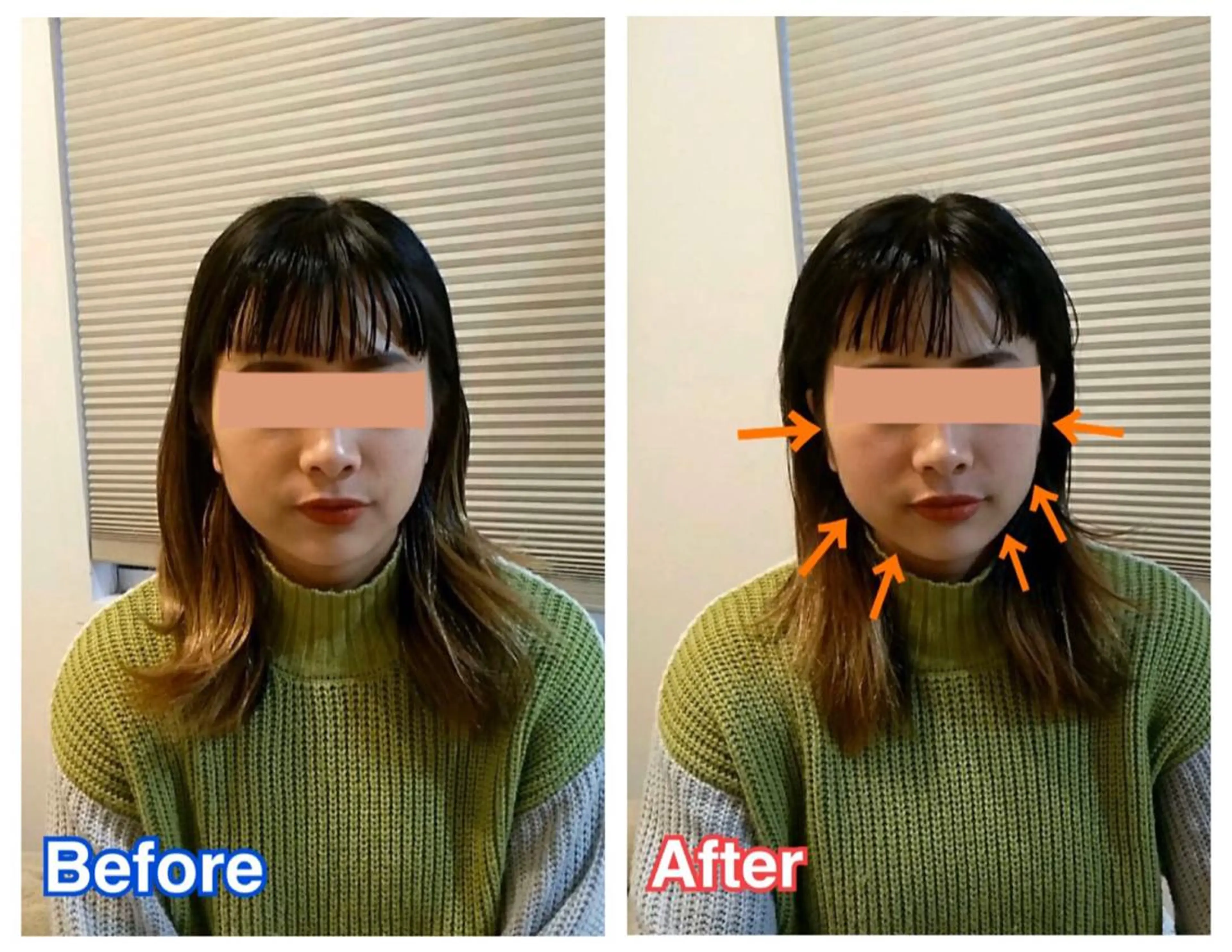 鍼灸 Refineのその他イメージ