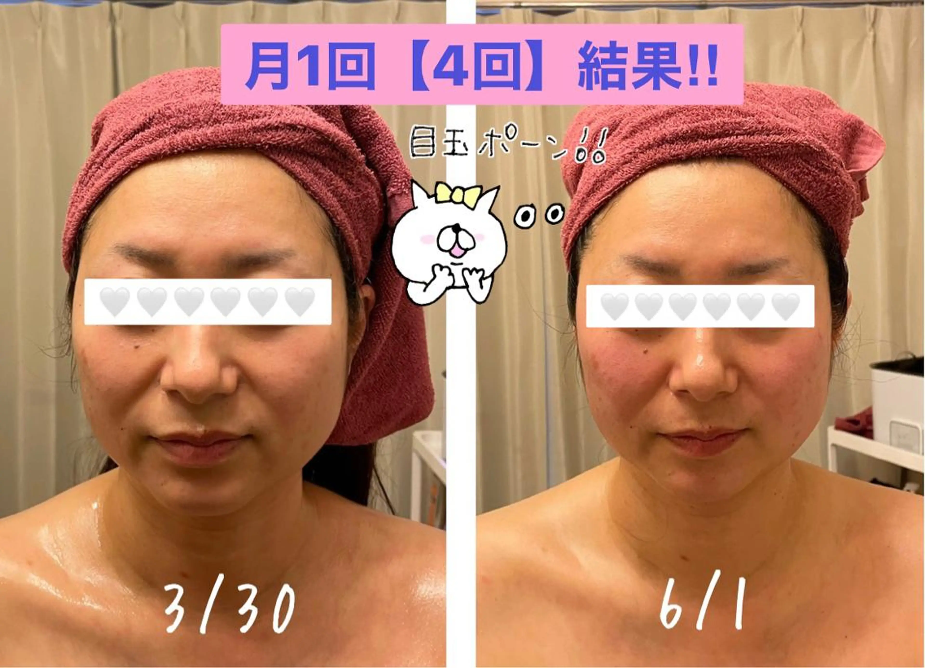35歳からの エイジングケアサロンのエステ・リラクイメージ