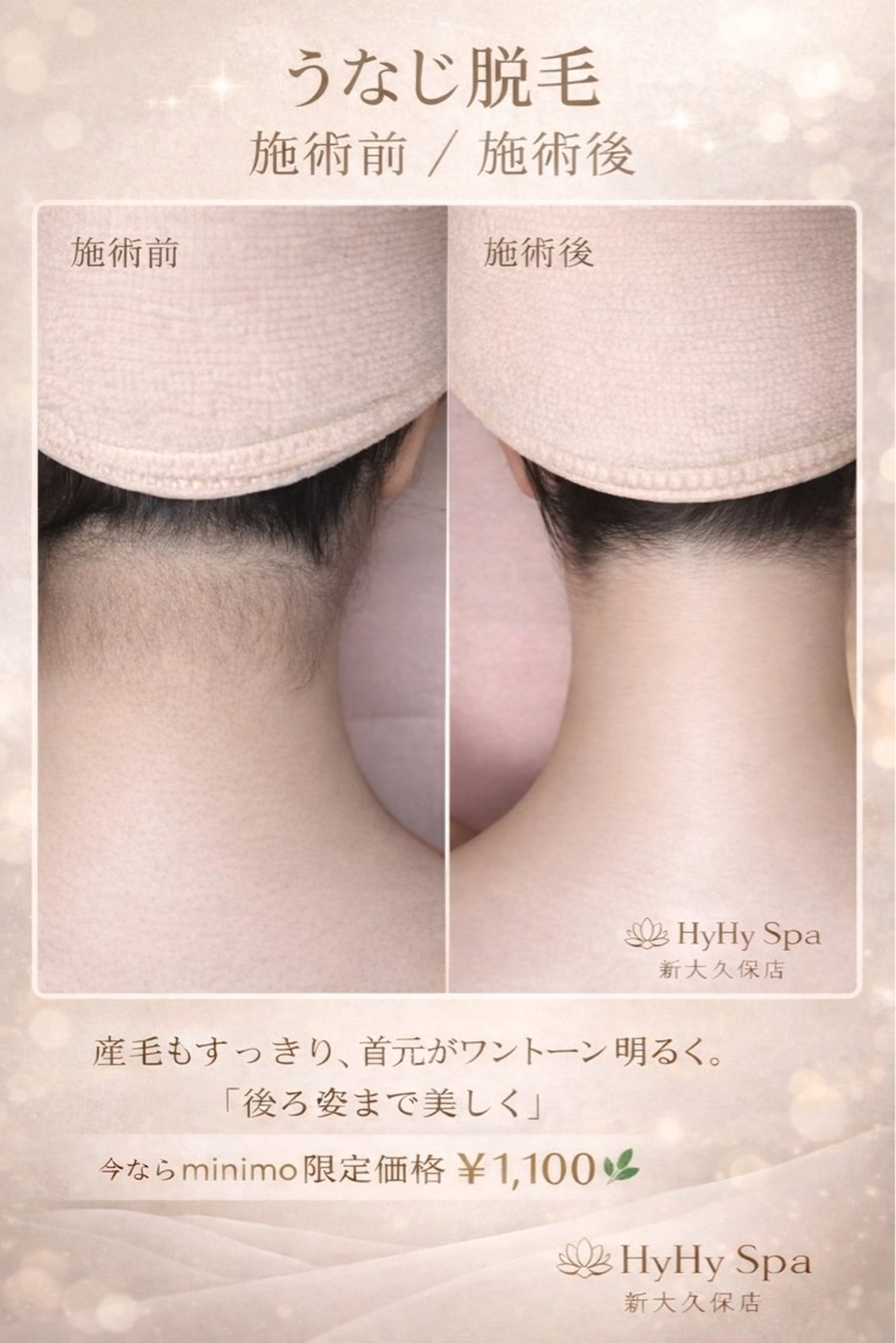 HyHy Spa 新大久保店のエステ・リラクイメージ