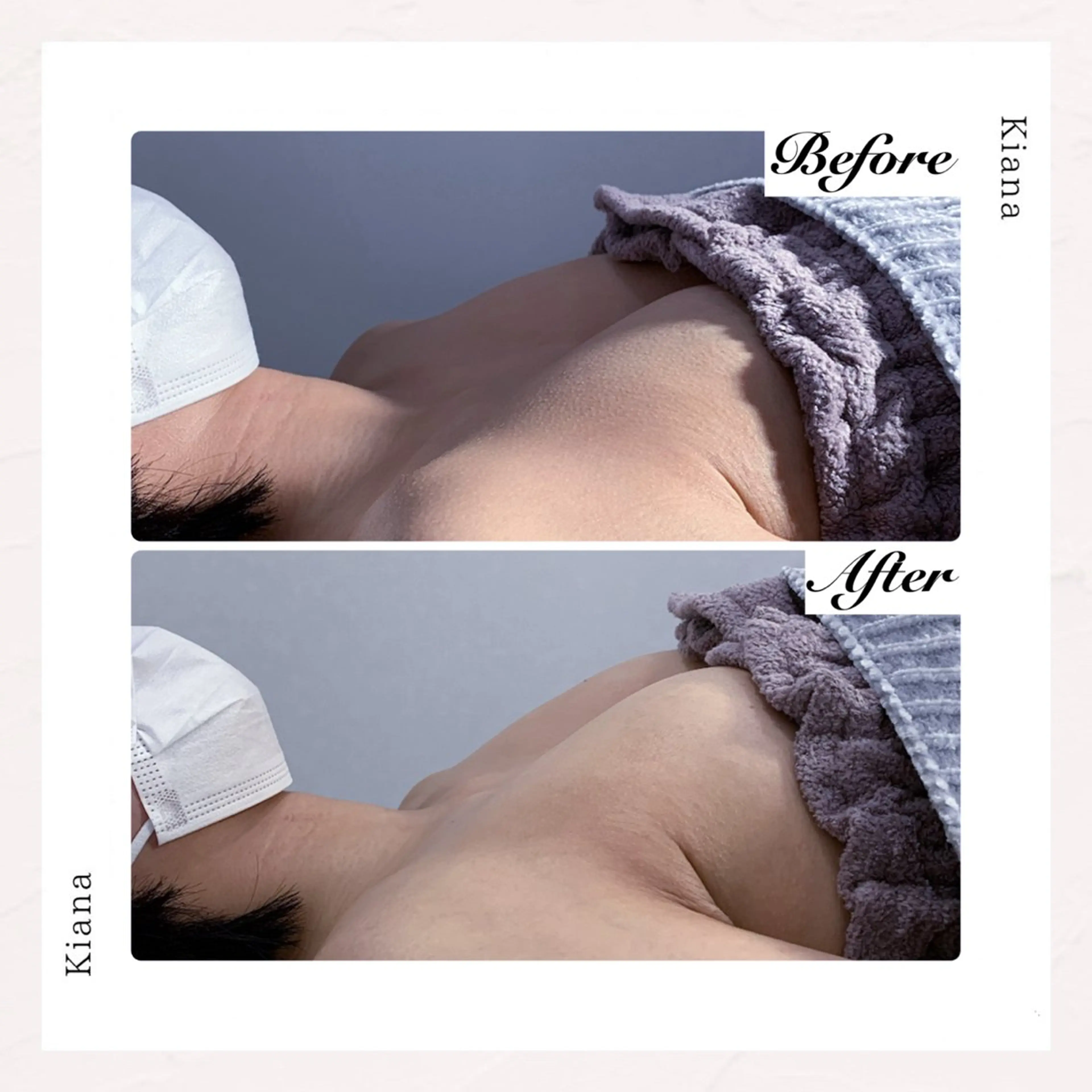 バスト専門Kiana 風のエステ・リラクイメージ