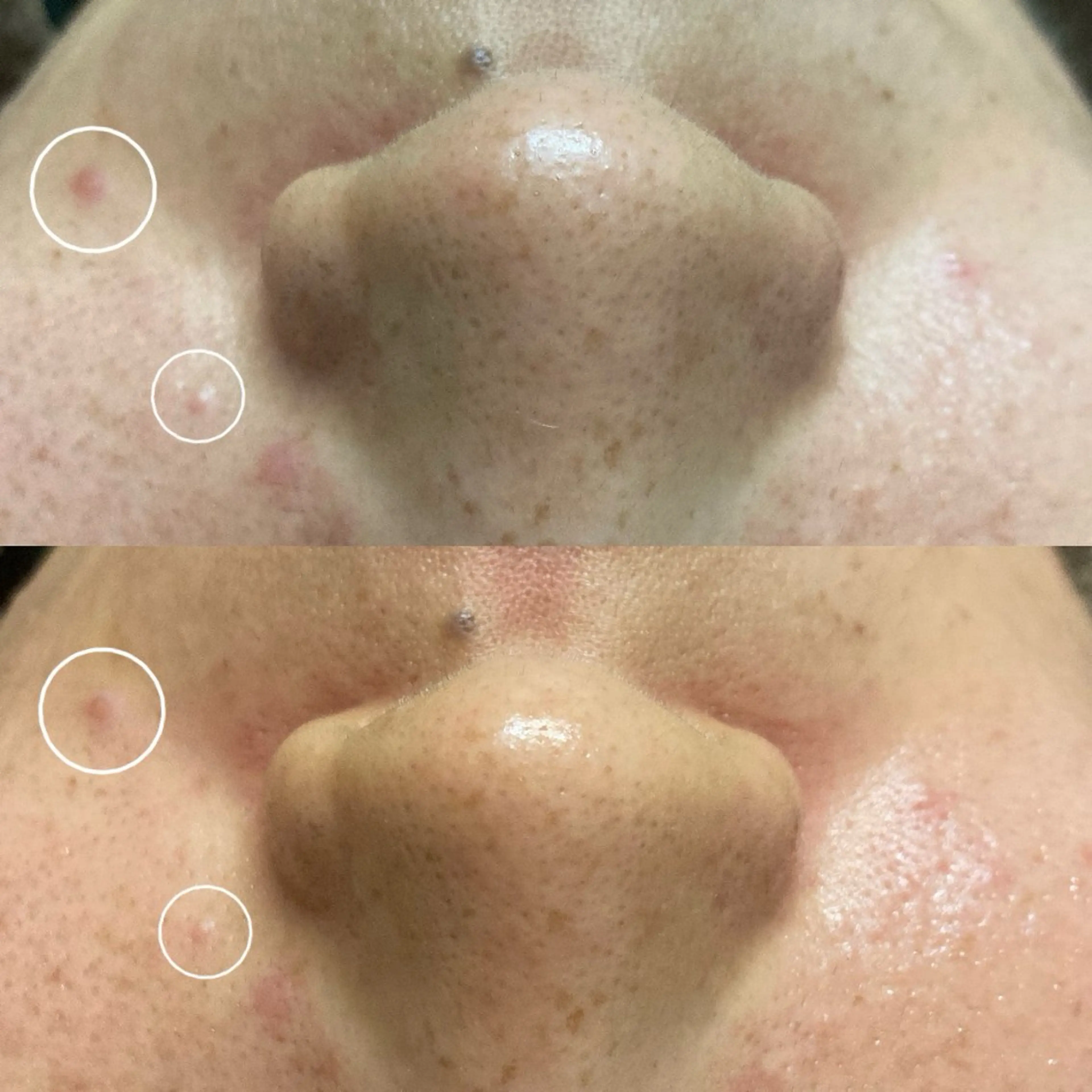 磐田｜LAYLA 一番丁寧な脱毛店のエステ・リラクイメージ