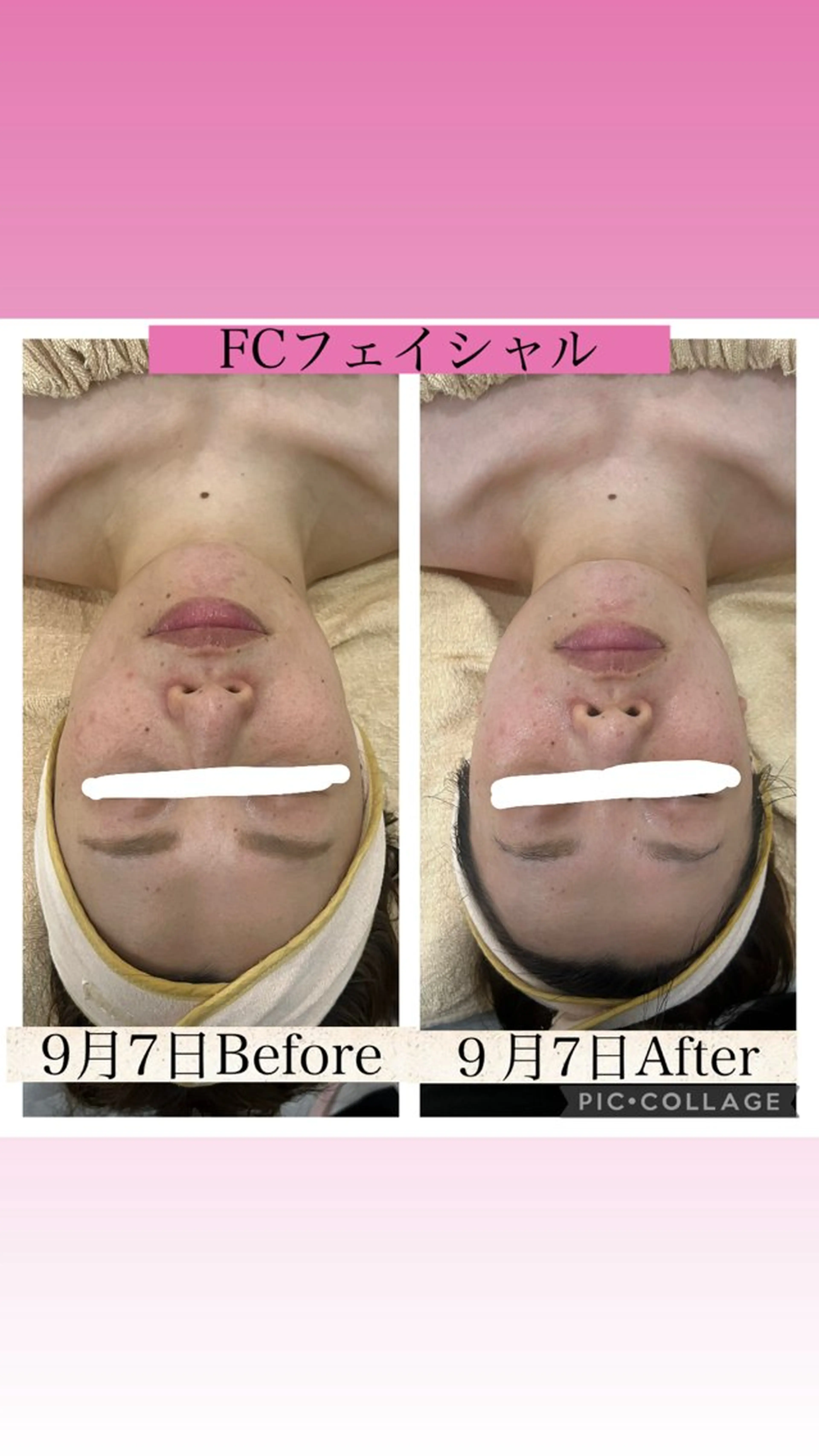 ブライダル痩身×脱毛 尼崎駅前サロンのエステ・リラクイメージ