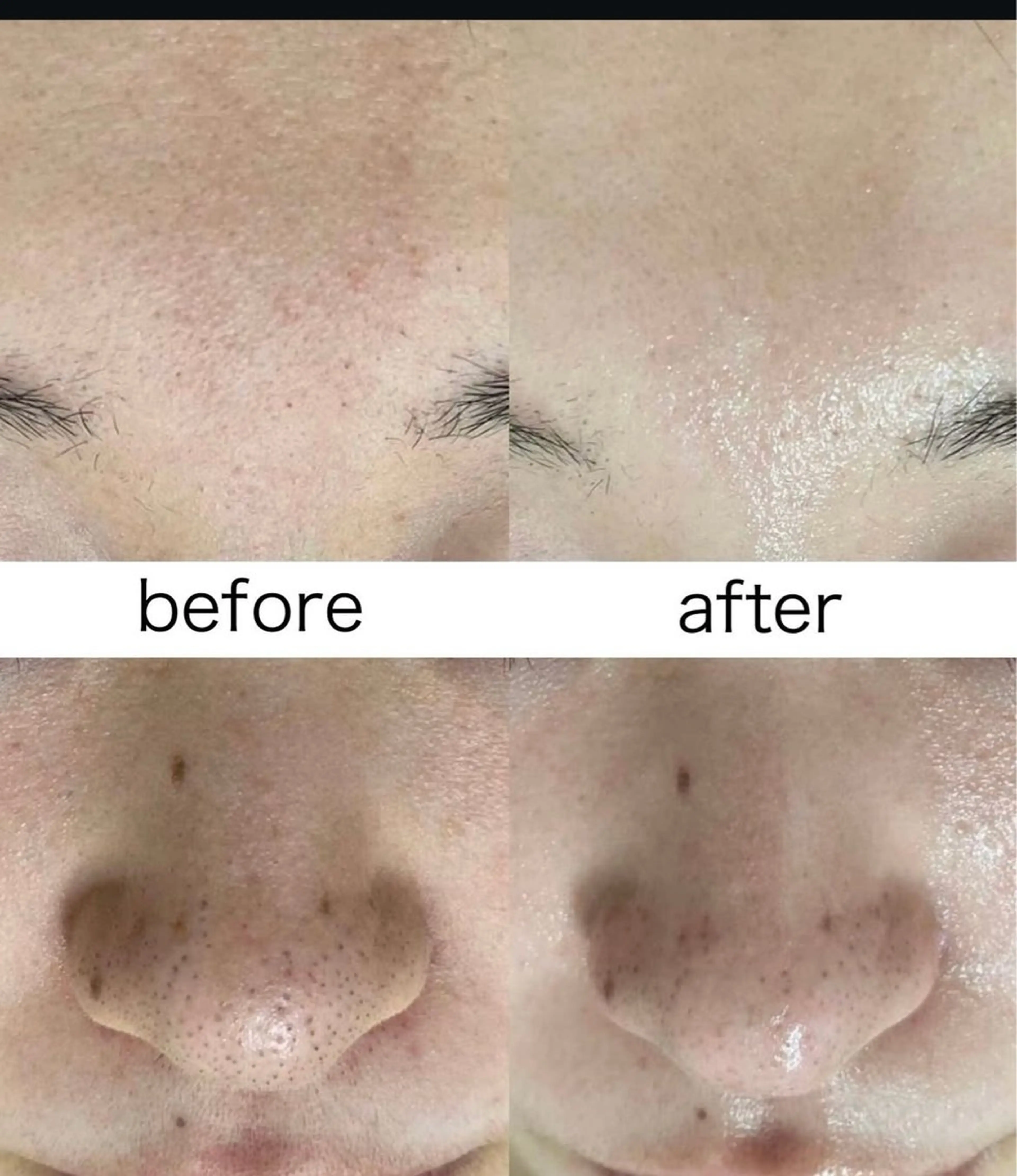 韓国美肌/肌質改善 【天神】のエステ・リラクイメージ