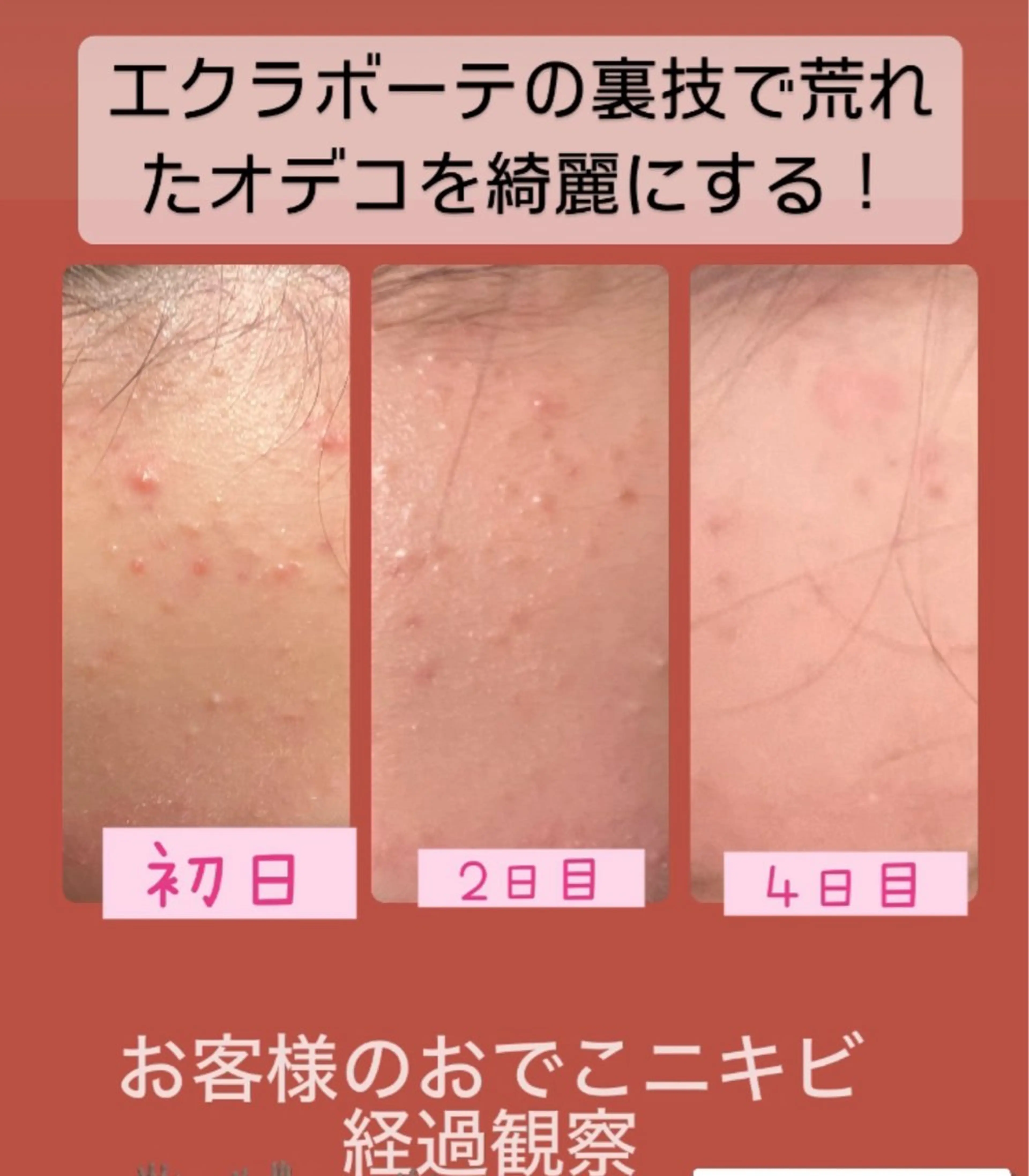 エステ 🅖🅤🅩🅔🅛 salonのエステ・リラクイメージ