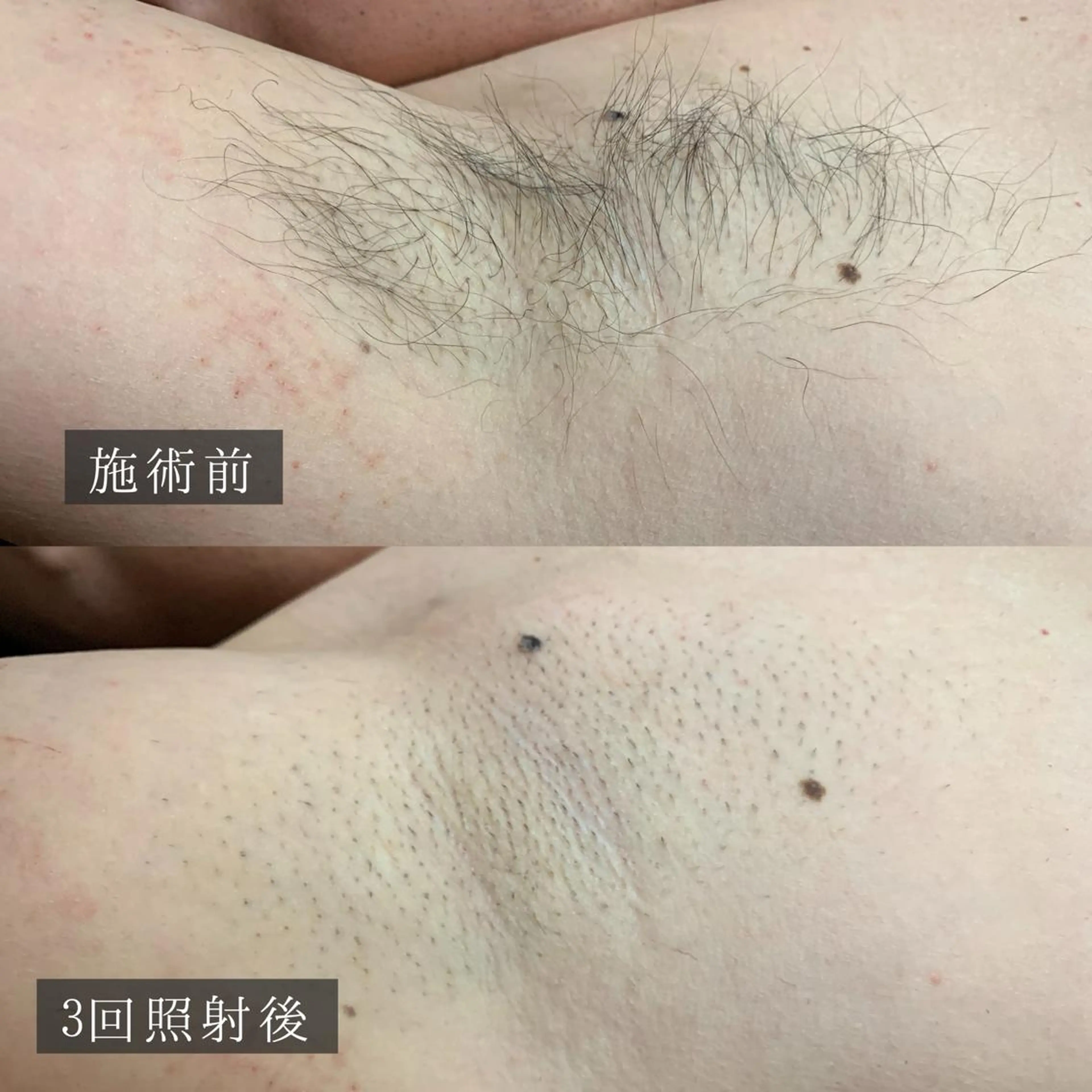 メンズ 脱毛専門サロン BELFINE恵比寿のエステ・リラクイメージ