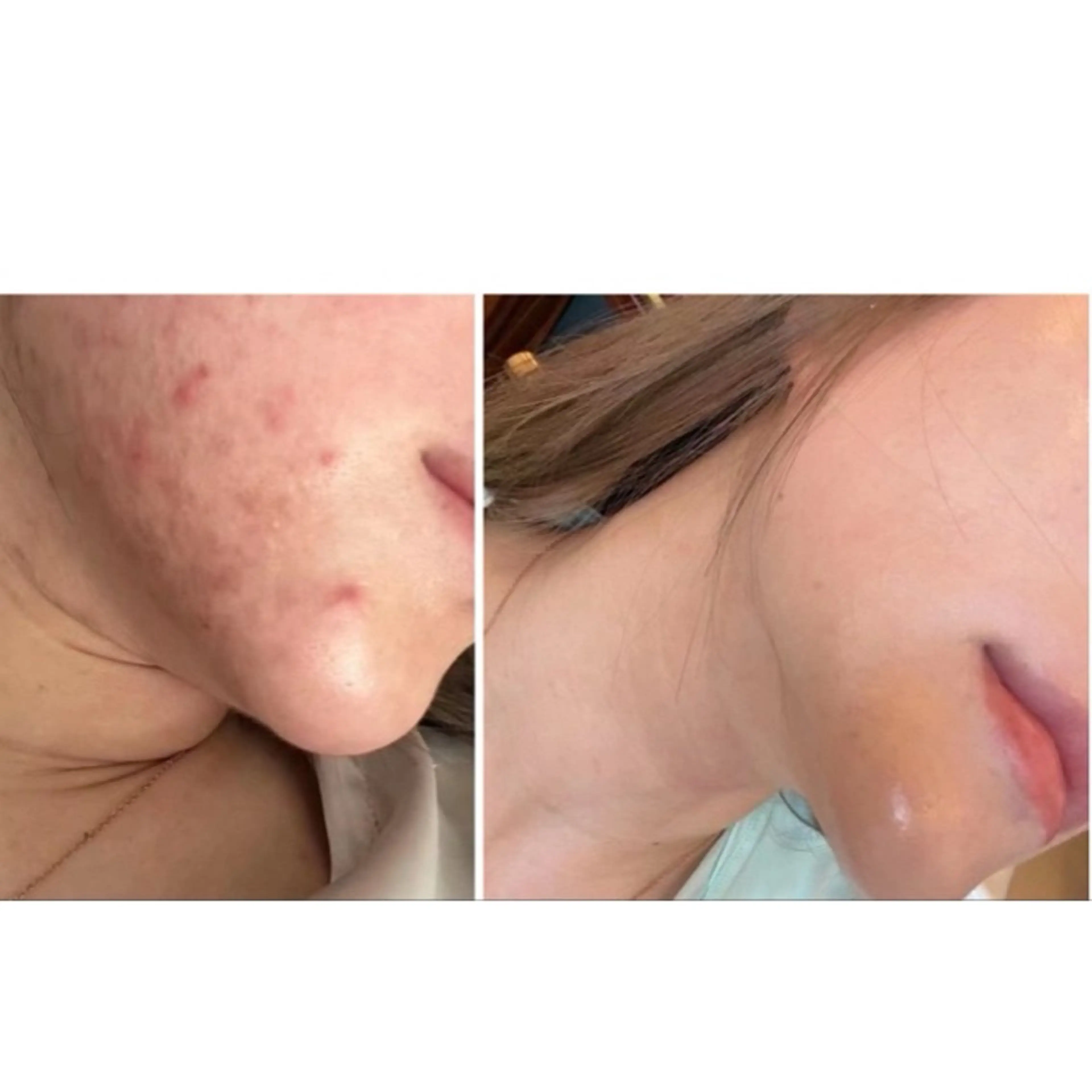 🍀 Momoのエステ・リラクイメージ