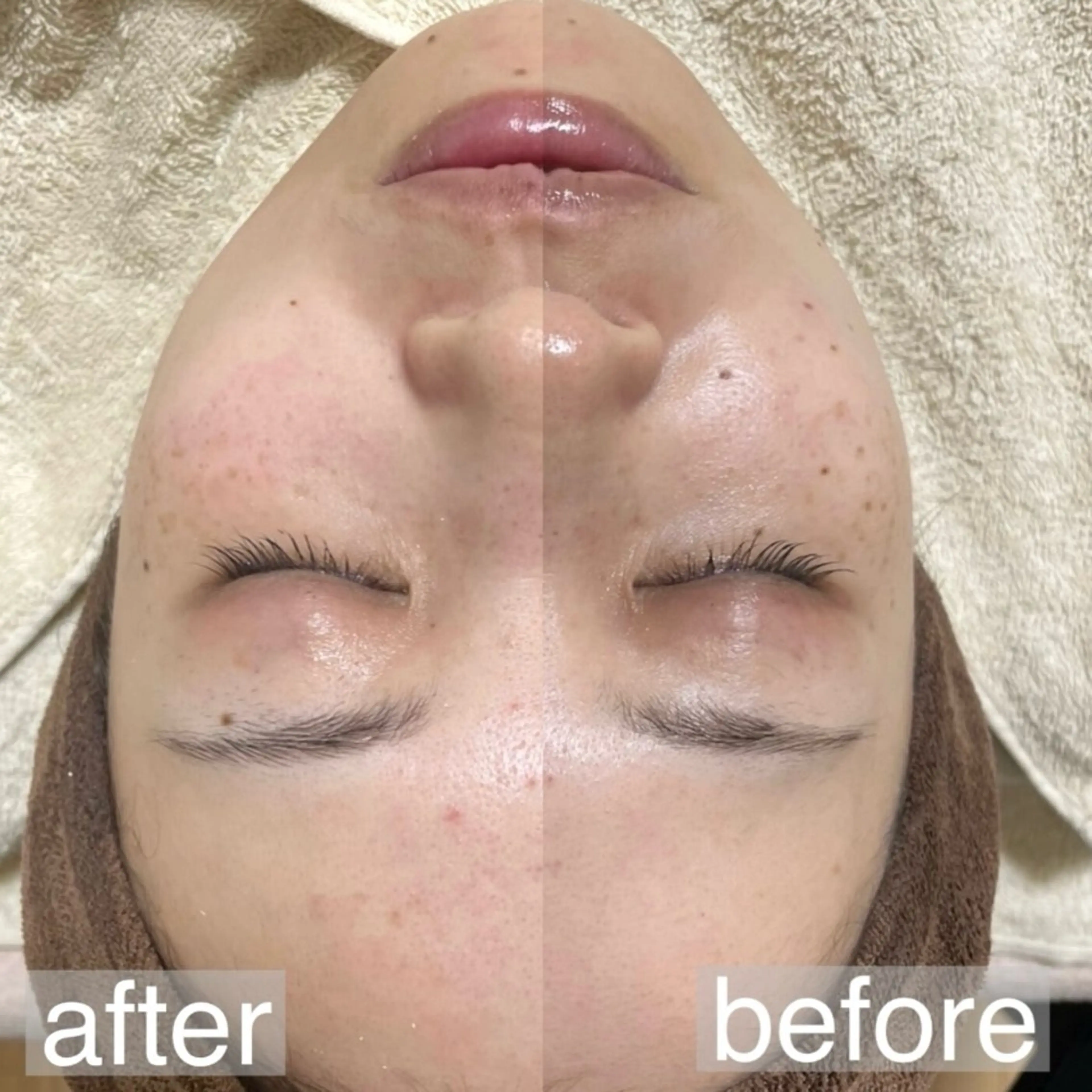 アイブロウ&フェイシャルサロンa‘lm所属・WAX脱毛/肌質改善 眉毛とお肌のサロンのエステ・リラクイメージ