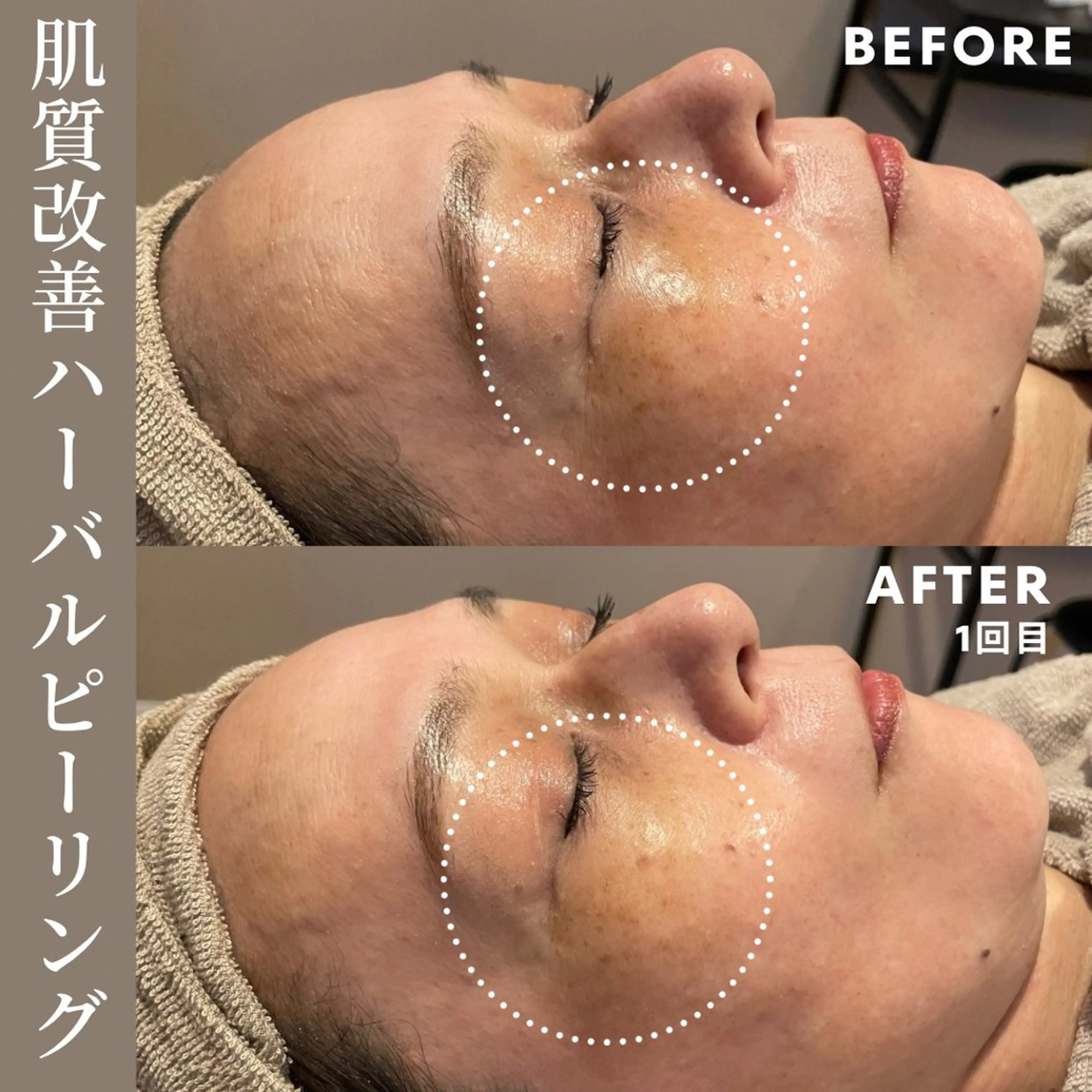 エステ Lassy Yuriの眉毛・アイブロウイメージ