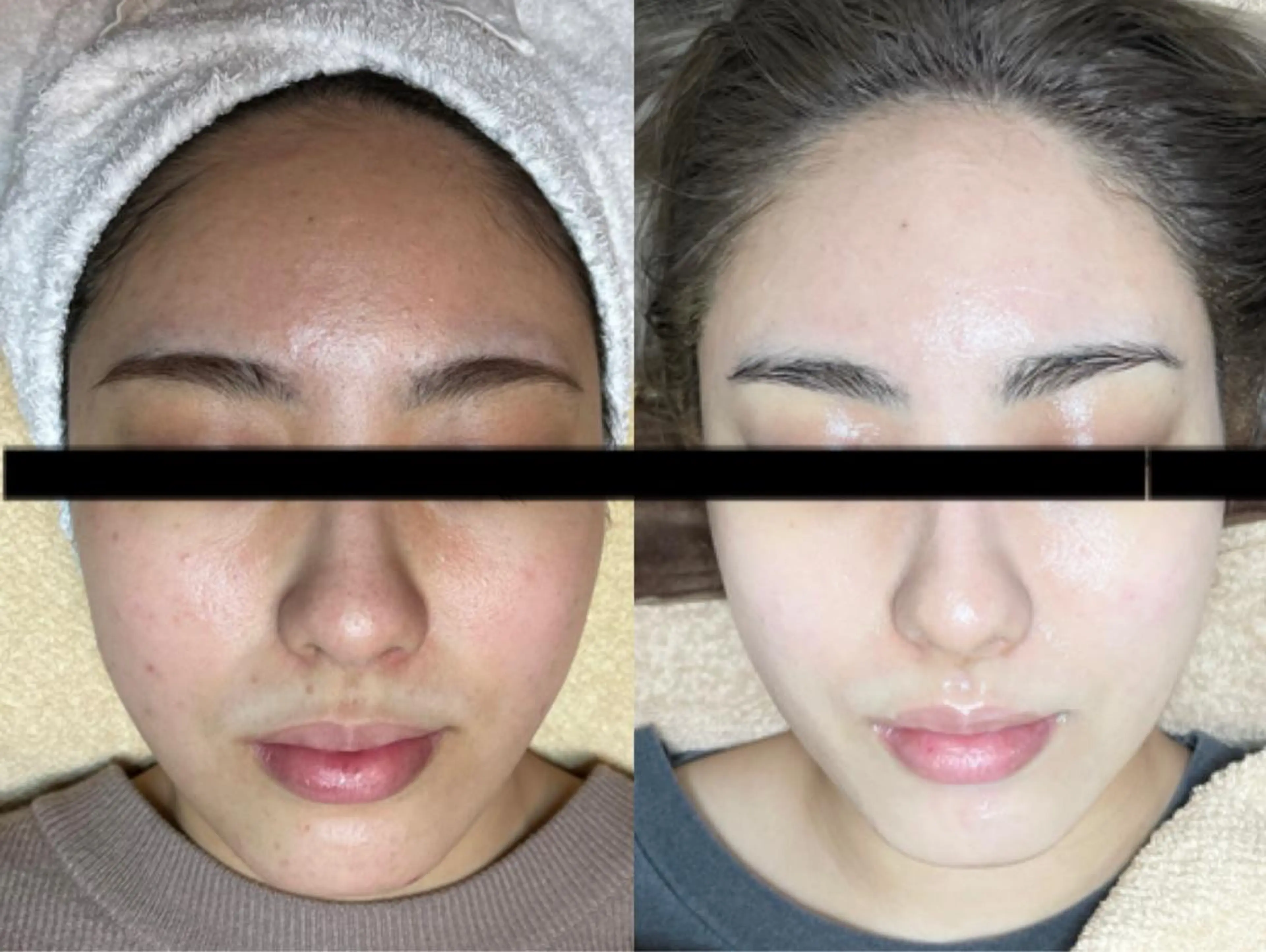 代表 MOMOのエステ・リラクイメージ