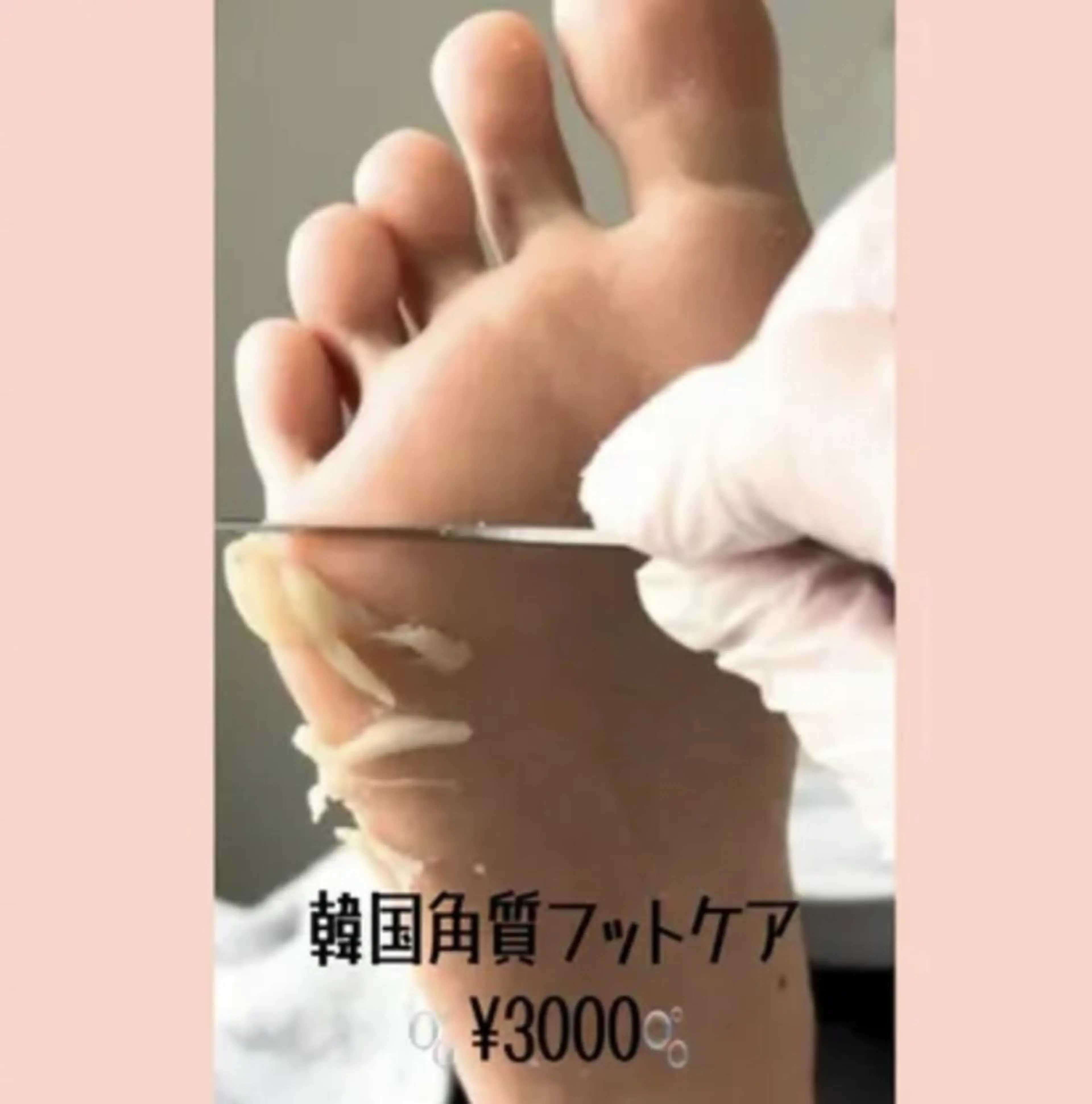 サロンドジュエ名古屋 メンズ脱毛レディースのエステ・リラクイメージ