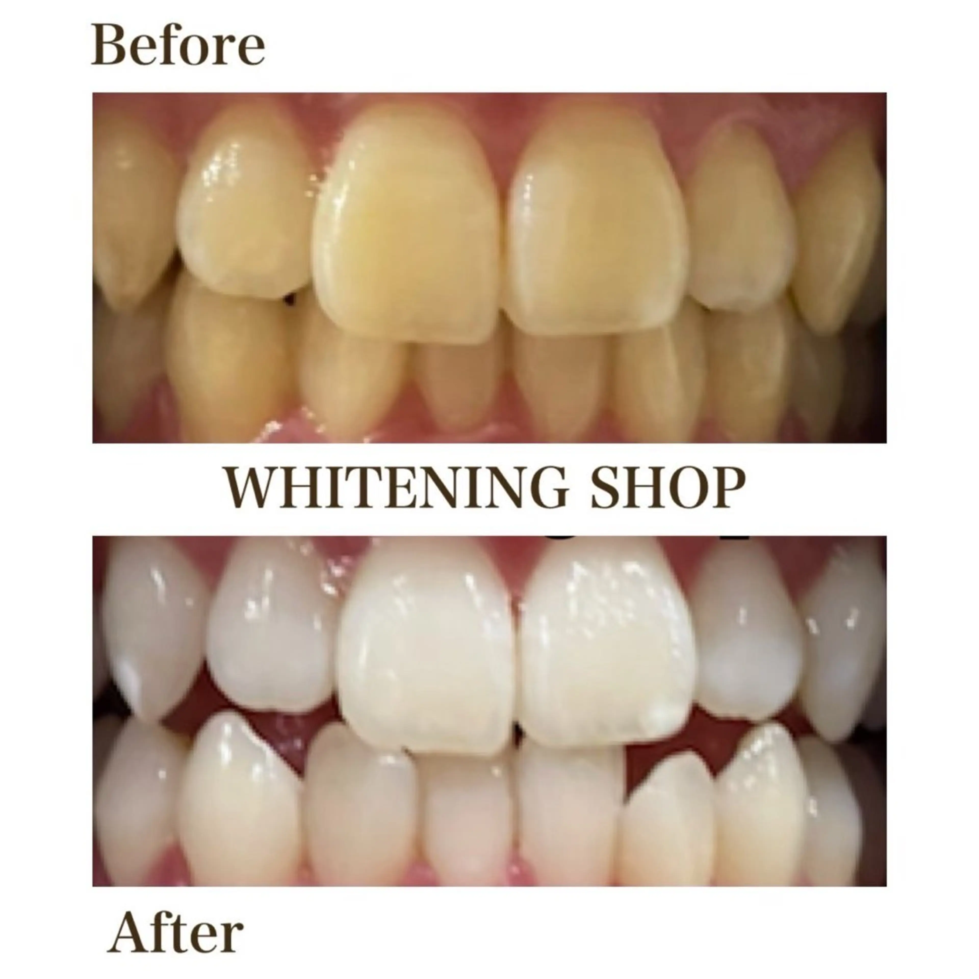 メンズ ホワイトニング ショップ葵区静岡駅店のその他イメージ