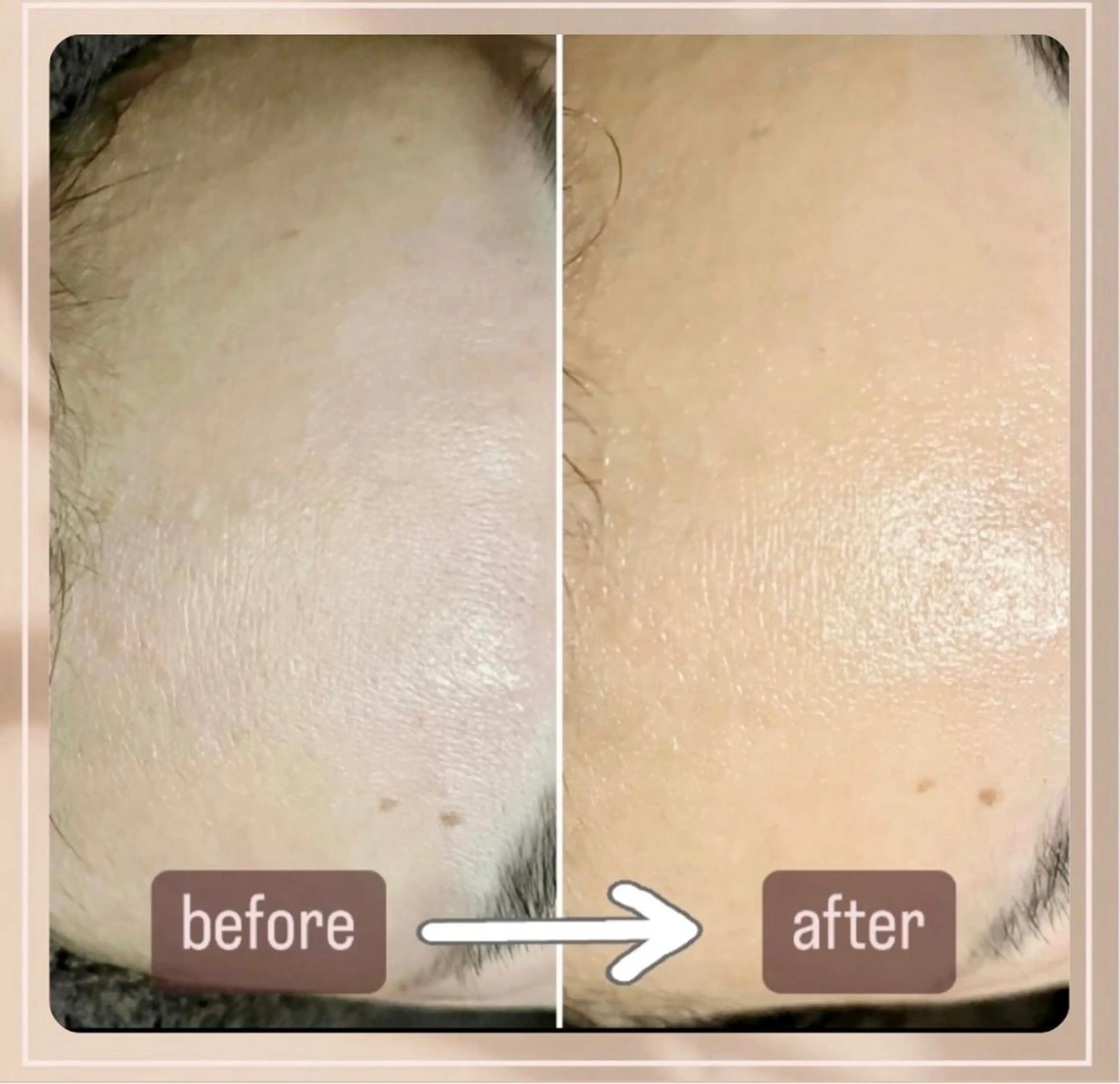 アイカワールド所属・鈴木 愛加のエステ・リラクイメージ