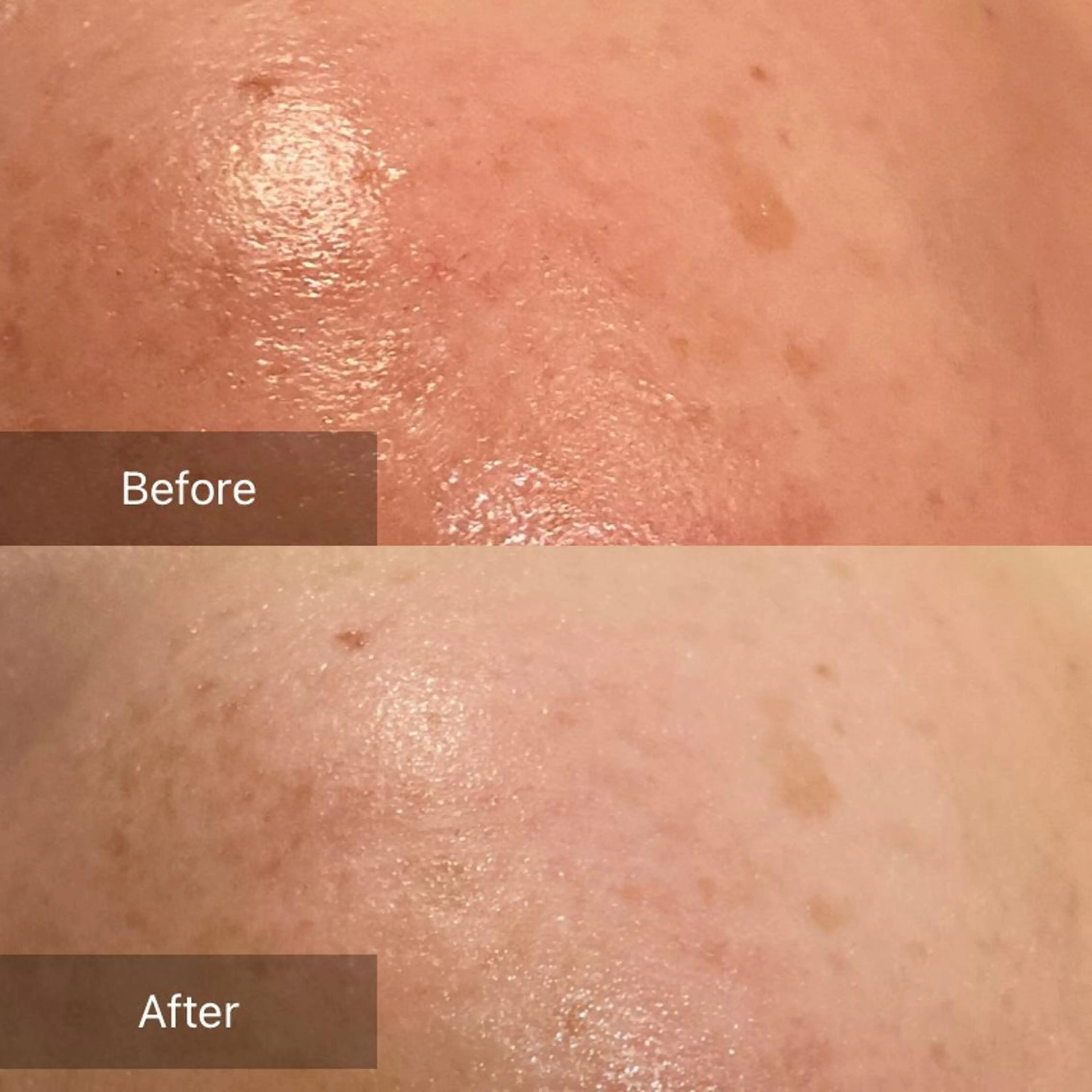 Mandarin Orange所属・毛穴から始める肌メン テマンダリンオレンジのエステ・リラクイメージ