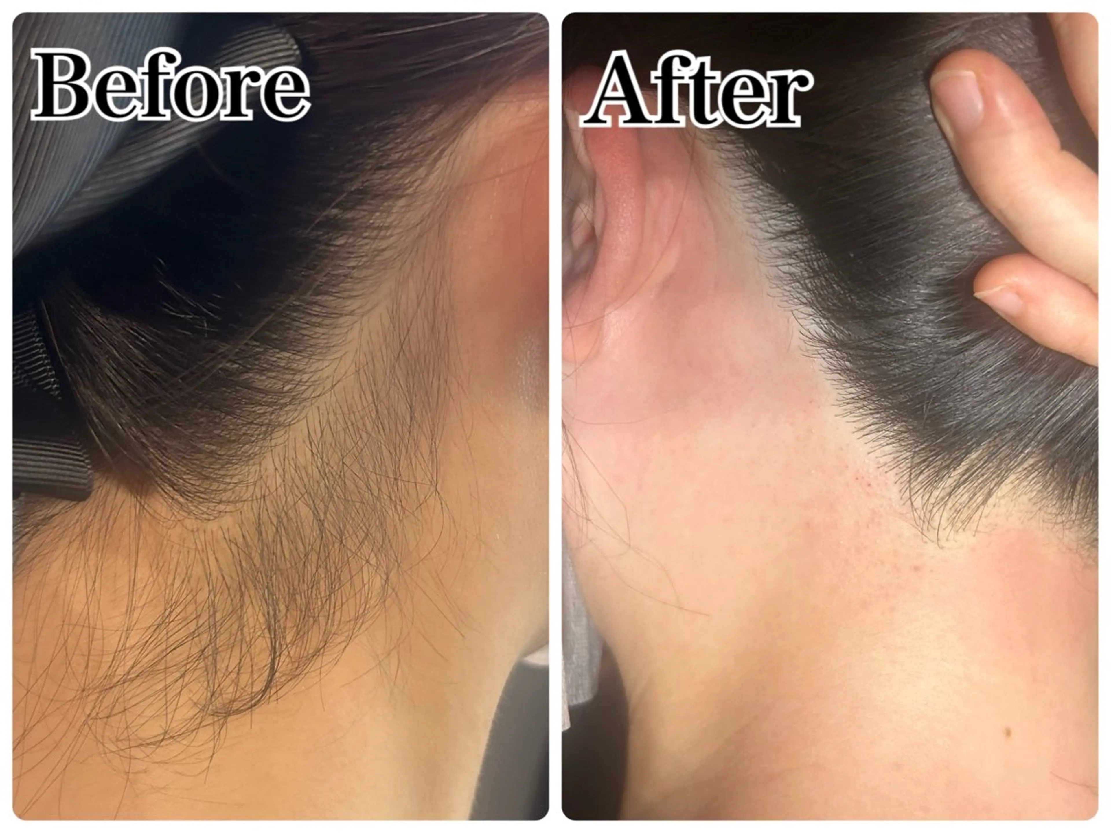 脱毛 Gemini 　MIKIのエステ・リラクイメージ