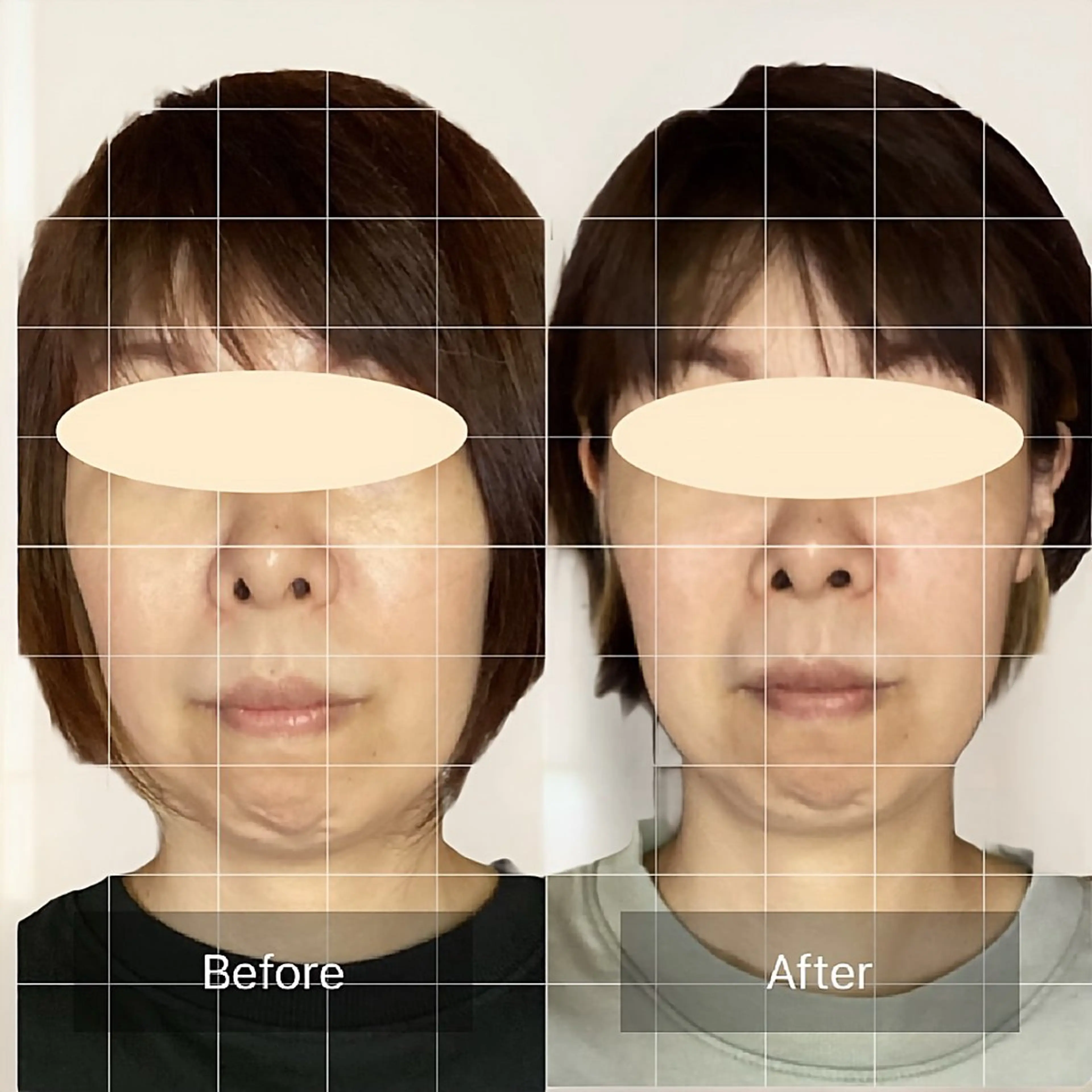 エステ リラク 小顔・歪み専門　井元 朋子のエステ・リラクイメージ