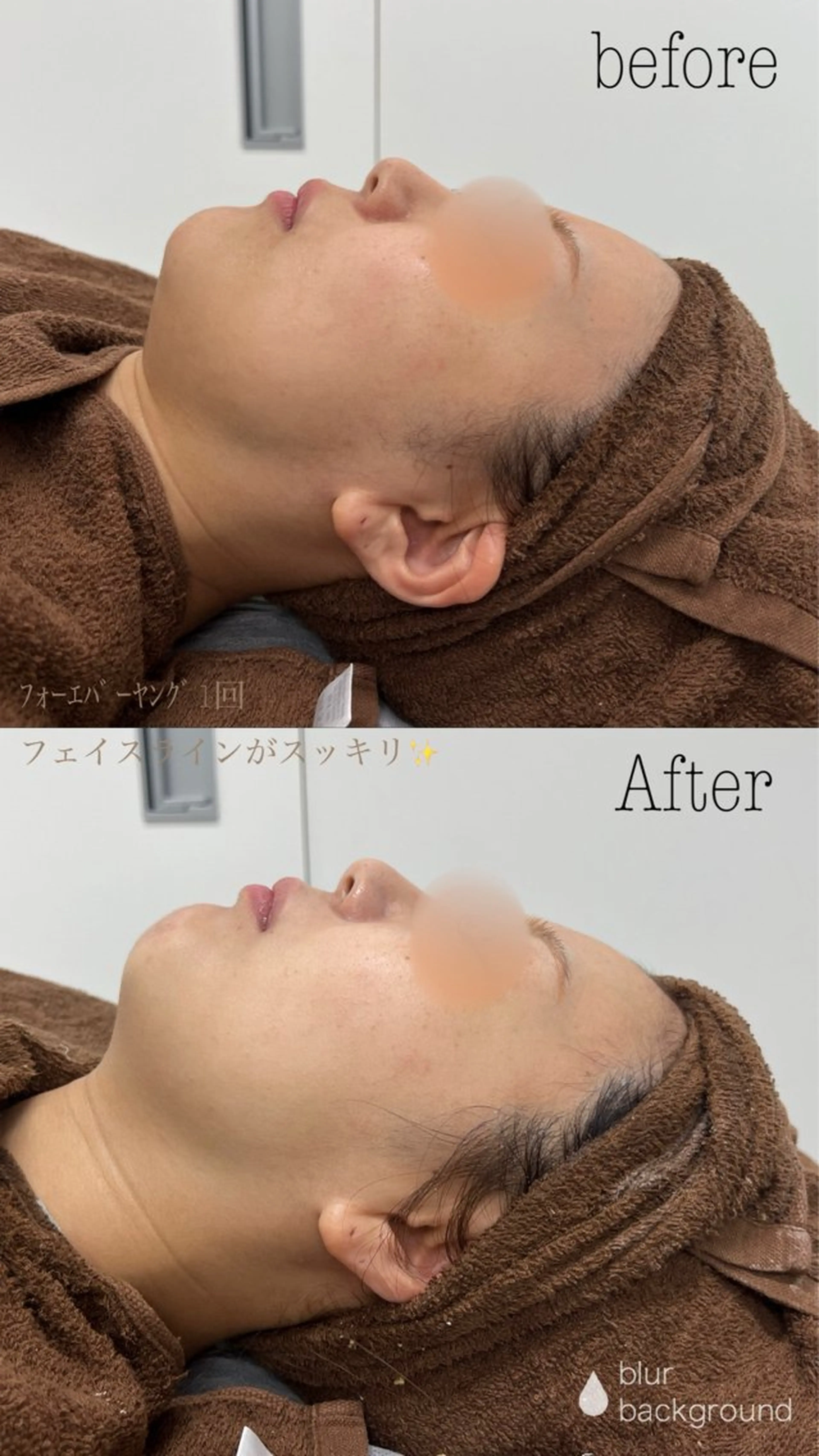 肌質改善|美眉サロン Cannone’のエステ・リラクイメージ