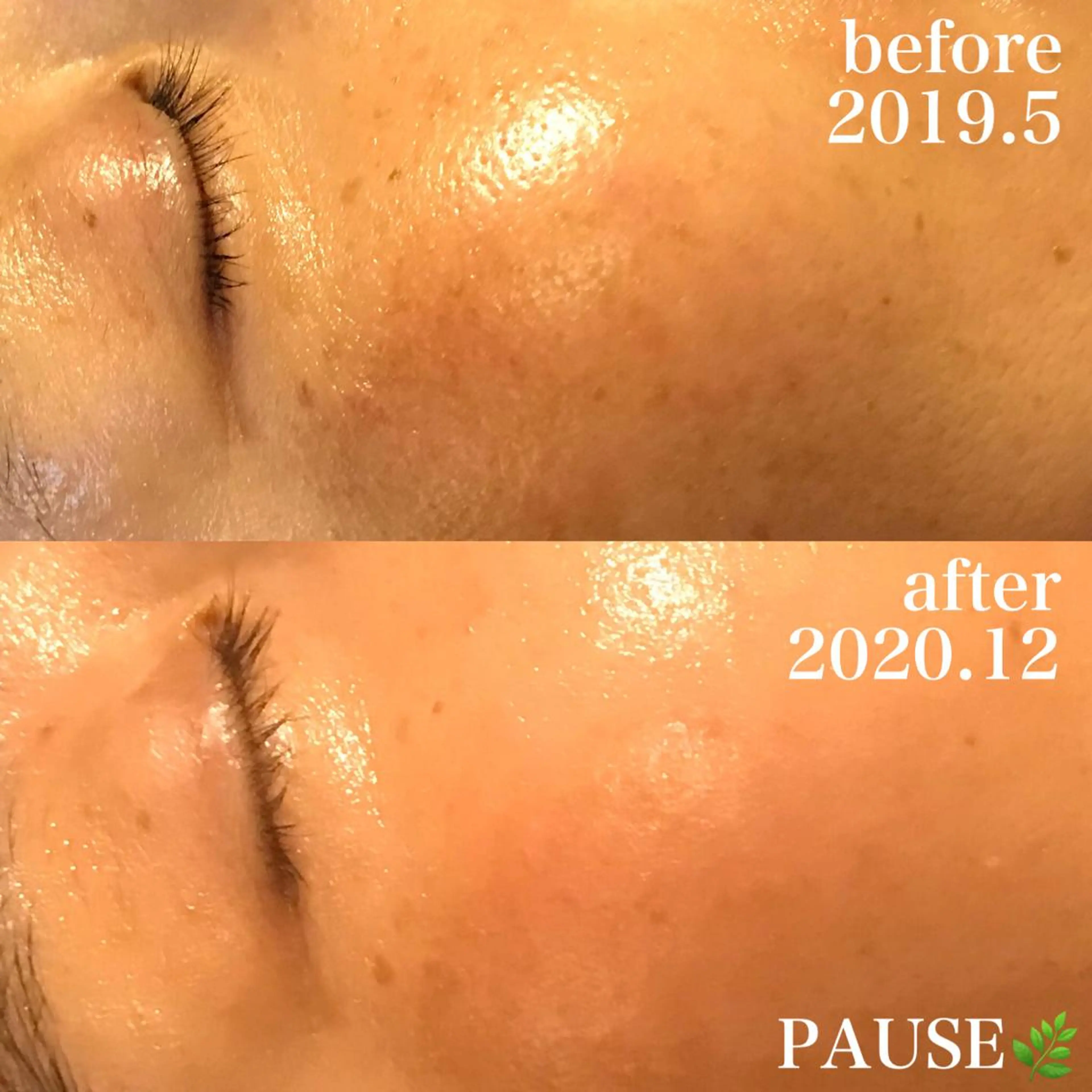 エステ 浜野 恵美のエステ・リラクイメージ