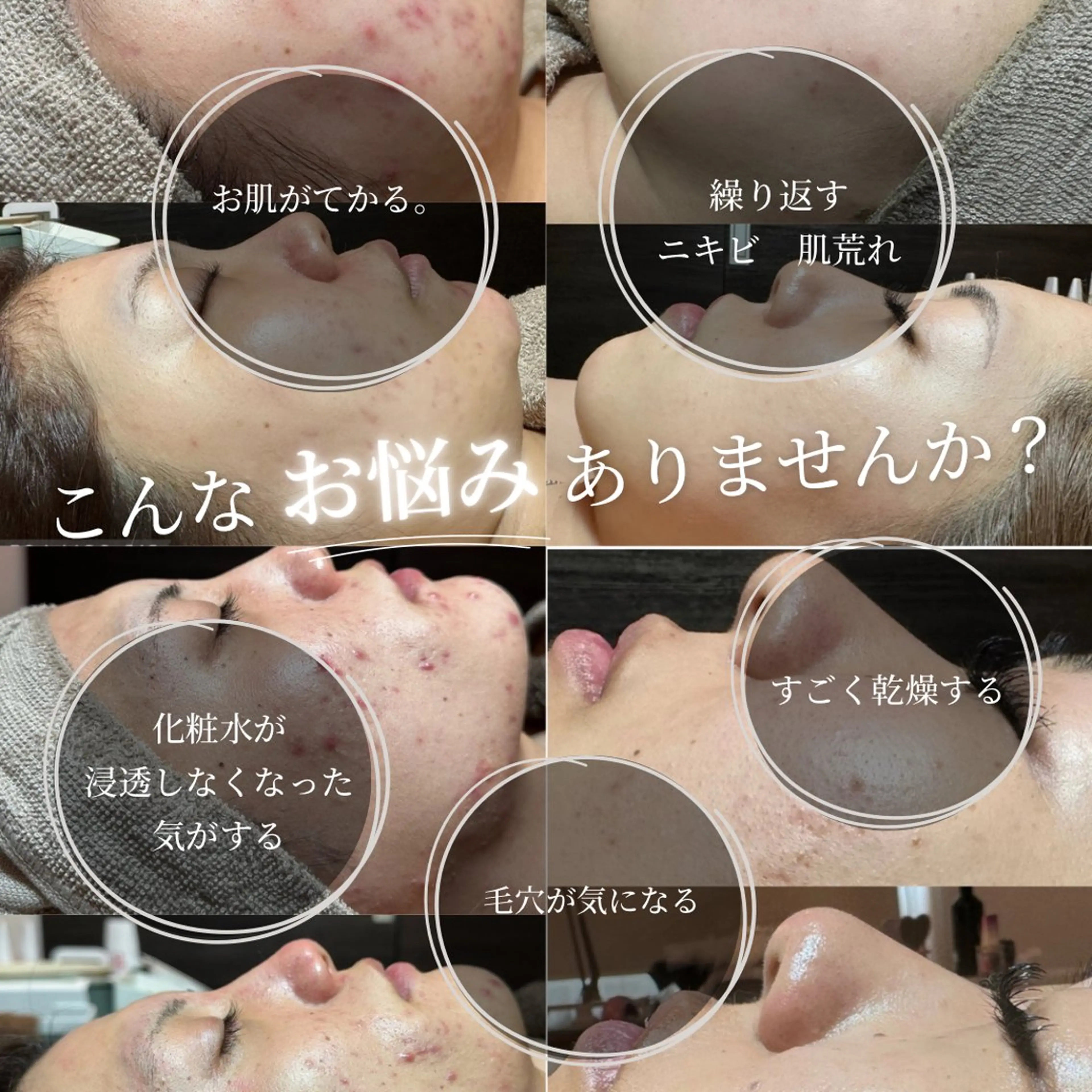 エステ Feel♡ JYURIAのネイルデザイン