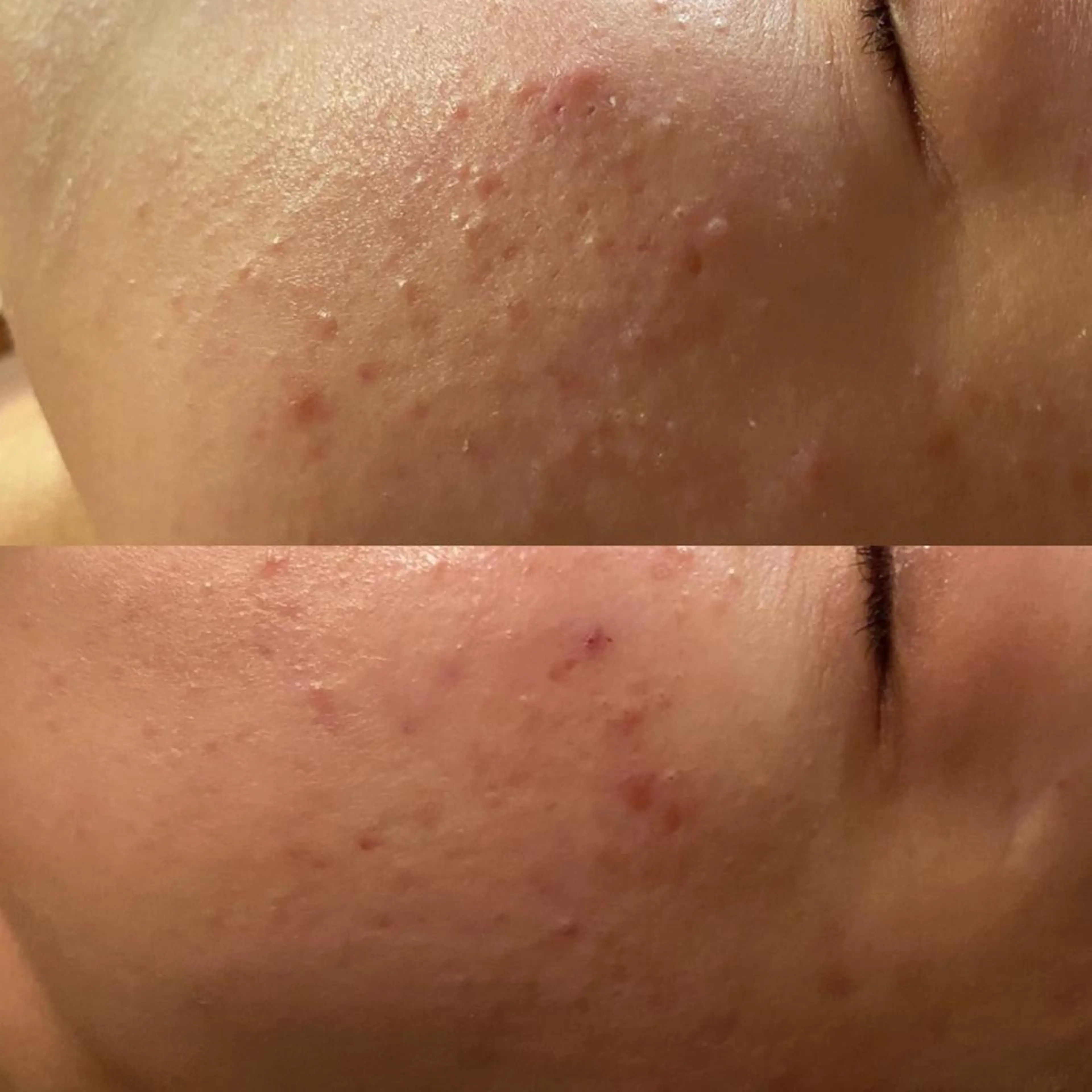 Mandarin Orange所属・毛穴から始める肌メン テマンダリンオレンジのエステ・リラクイメージ