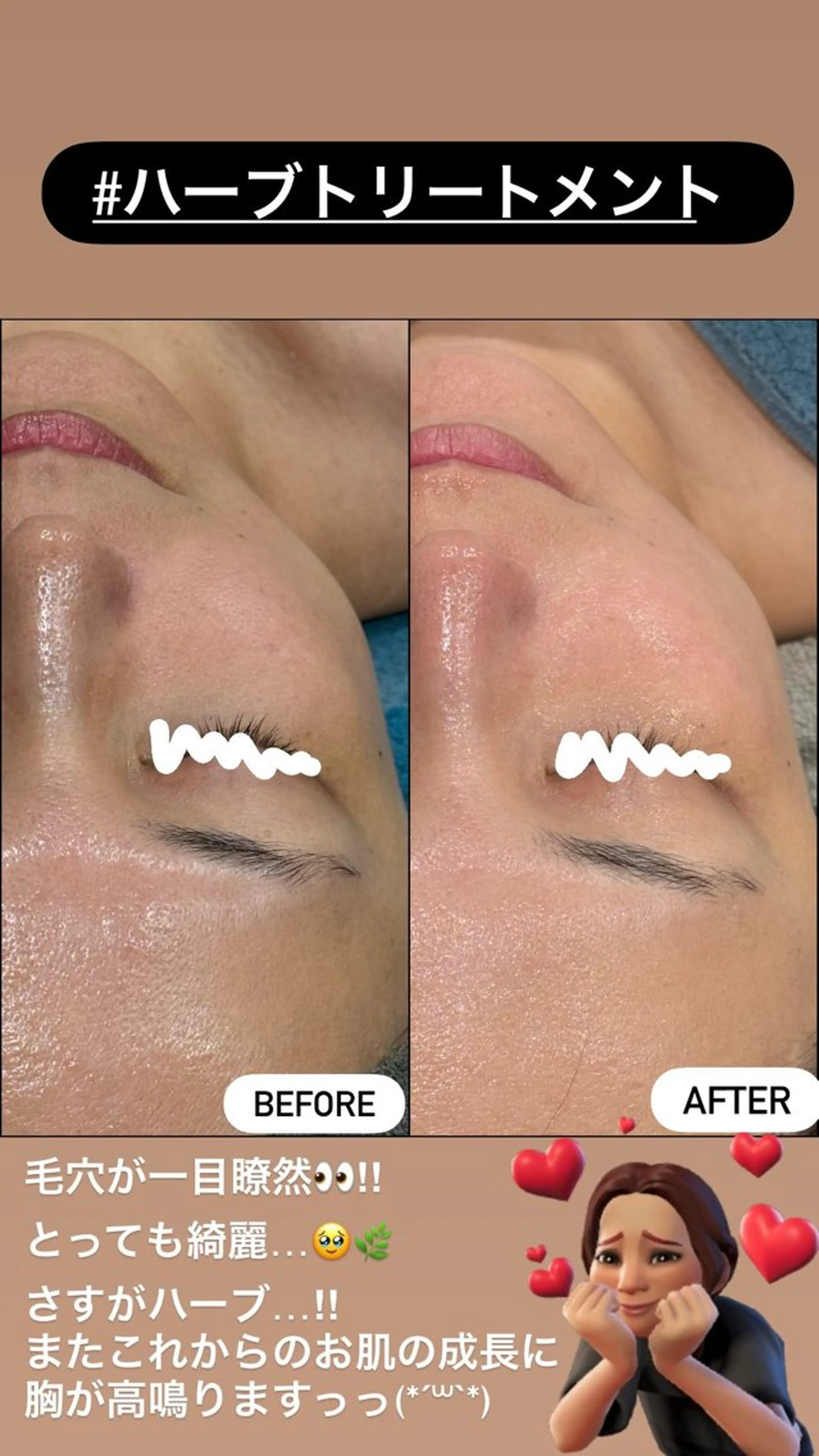 エステ LiZA エステティックサロンのエステ・リラクイメージ