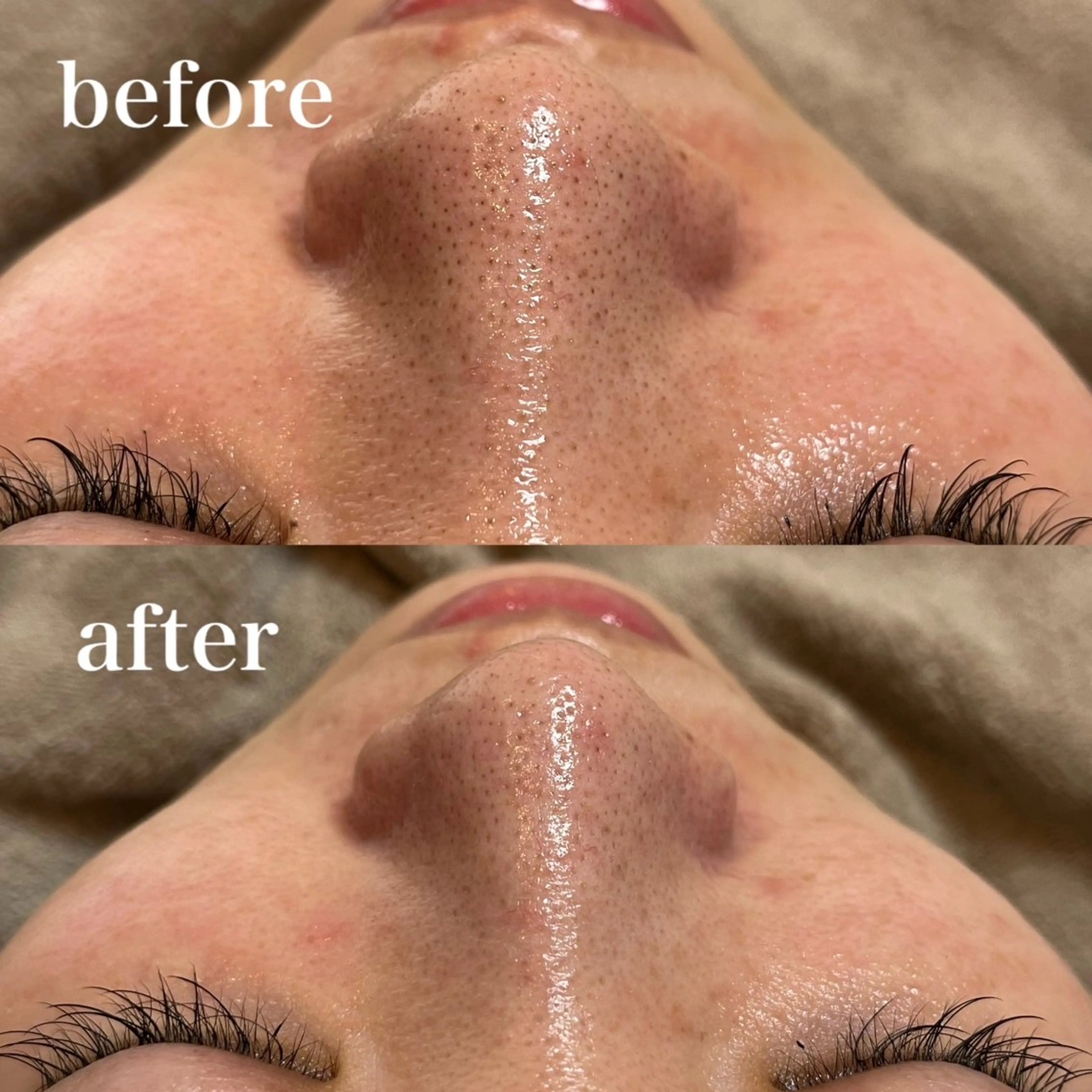 unsui spa 渋谷区神泉のエステ・リラクイメージ