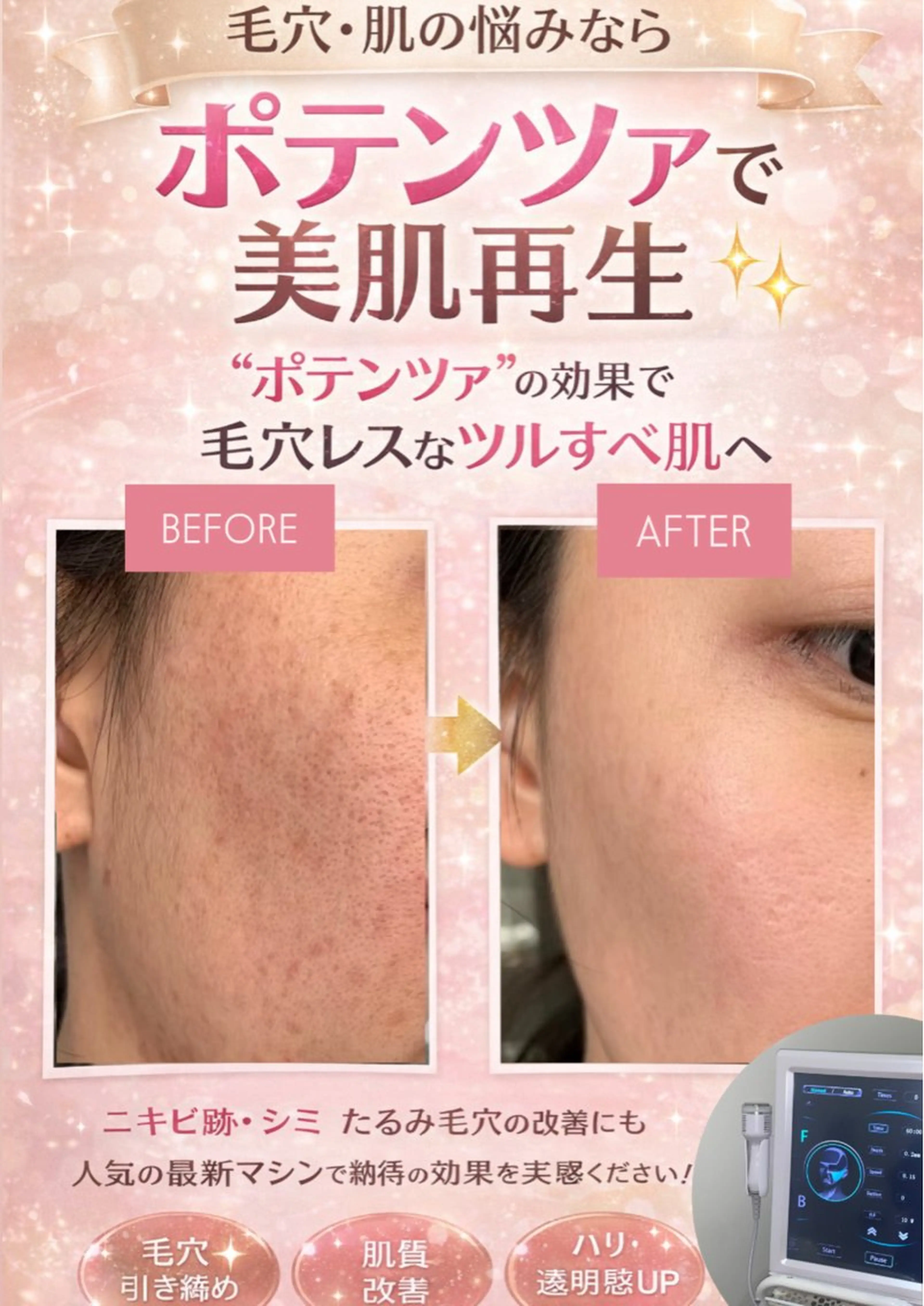 マツエク・マツパ エステ 愛維美水光美肌専門店 メンズレディースokのエステ・リラクイメージ