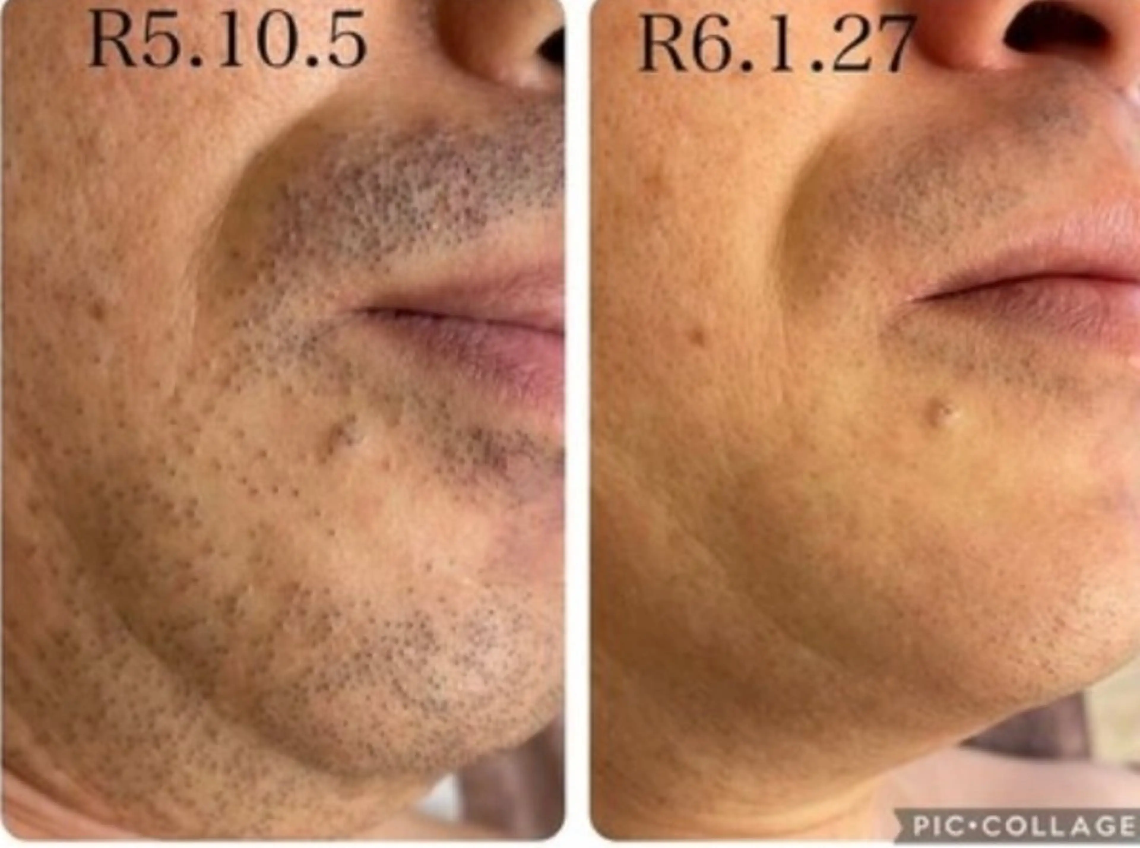 メンズ キッズ 脱毛サロン&ハーブピーリングFIS大和店所属・脱毛サロン FIS大和店のエステ・リラクイメージ