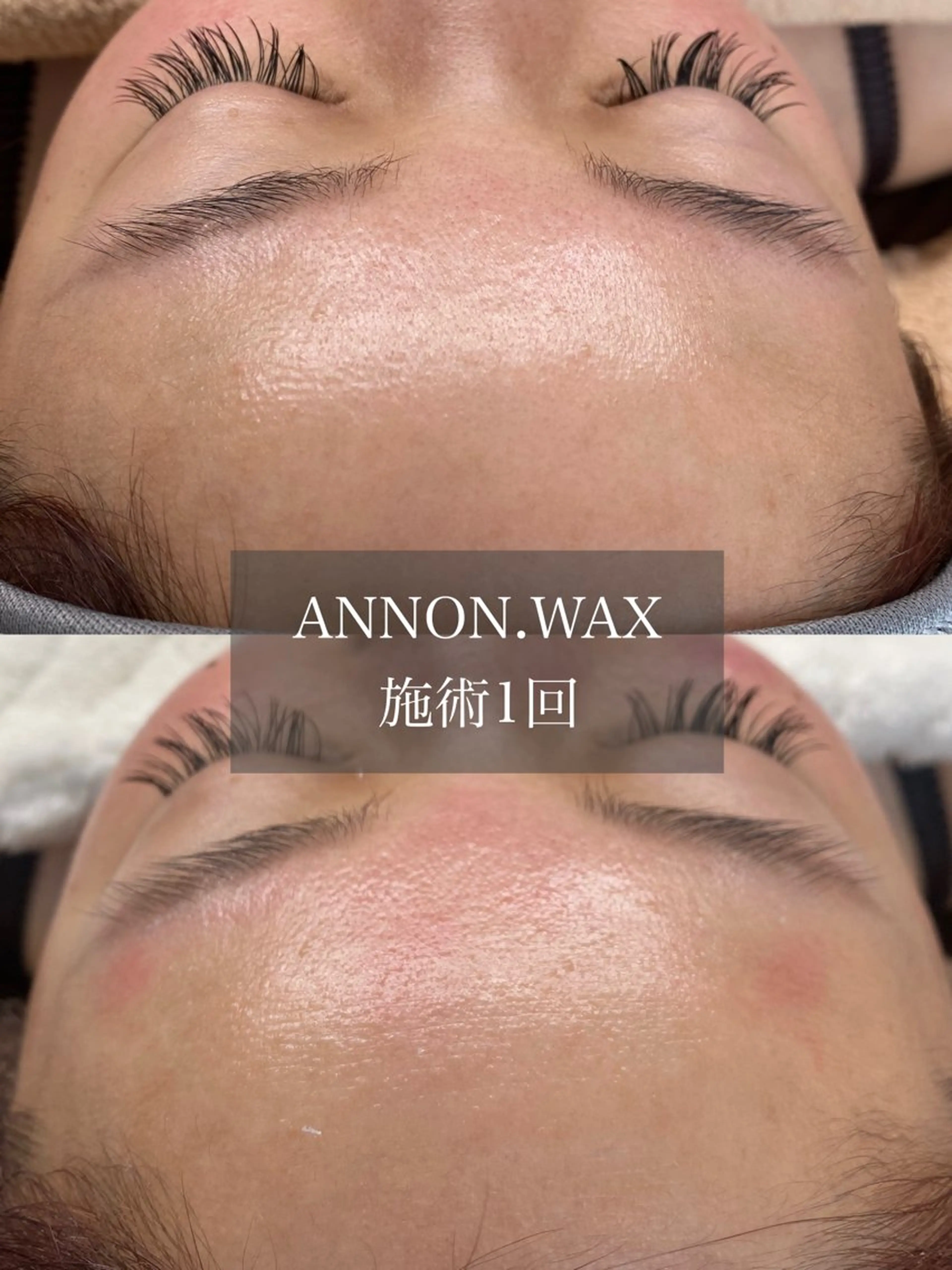 エステ 肌質改善ワックス専門 yukiのエステ・リラクイメージ