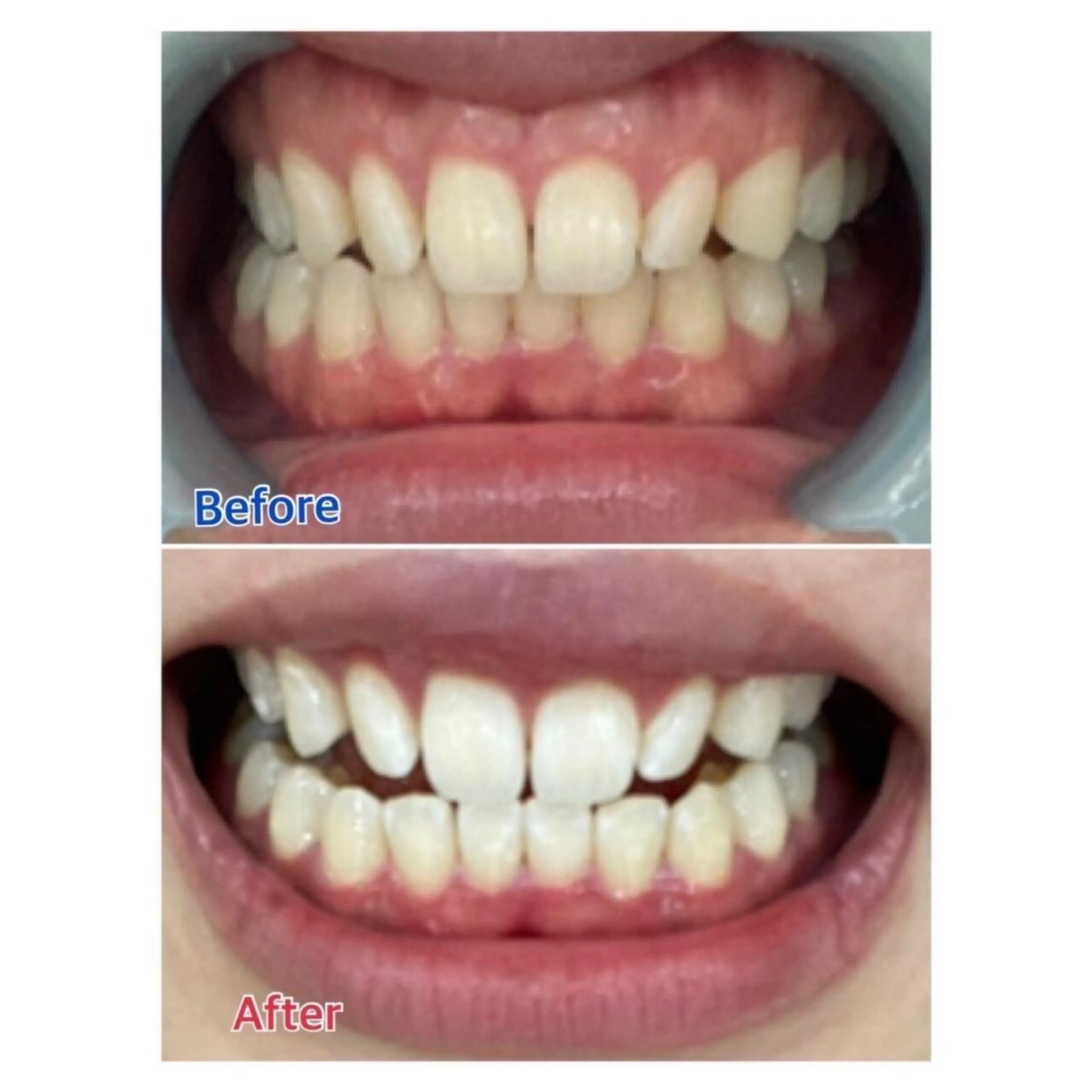 M渋谷 ホワイトニングのエステ・リラクイメージ