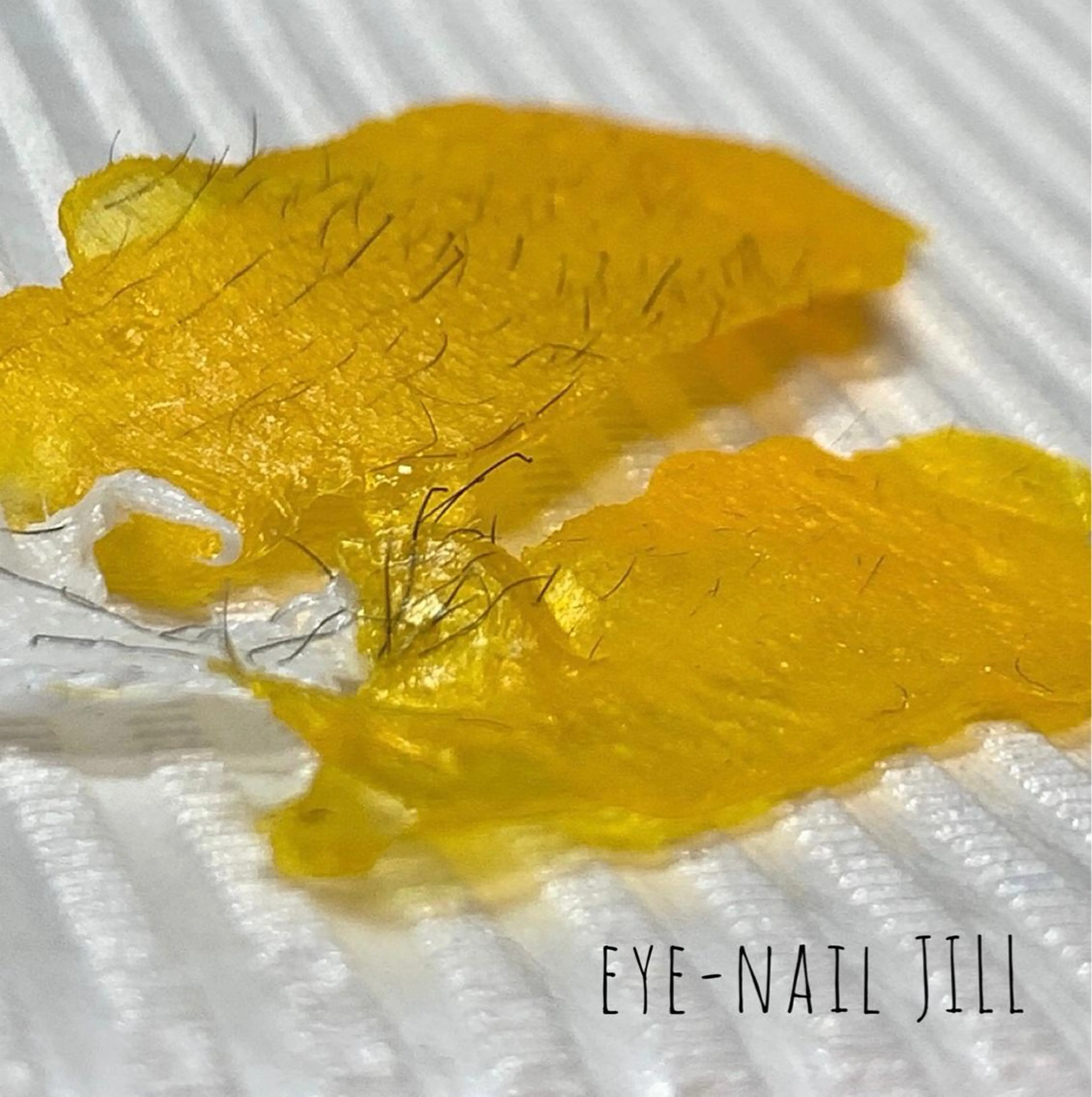 脱毛 JILL sa-yaのネイルデザイン