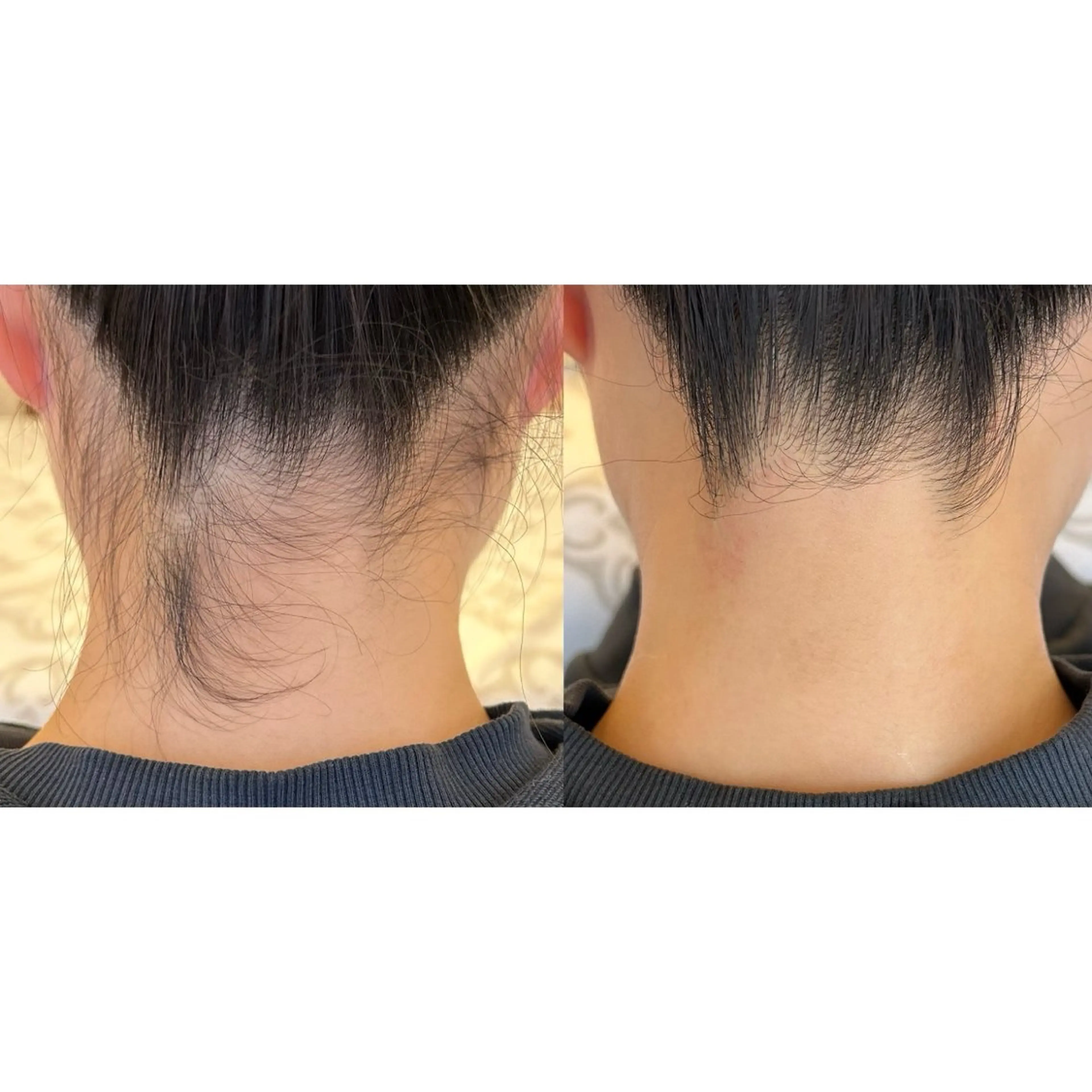 ワックス脱毛🌈 ESPOIRnocoのエステ・リラクイメージ