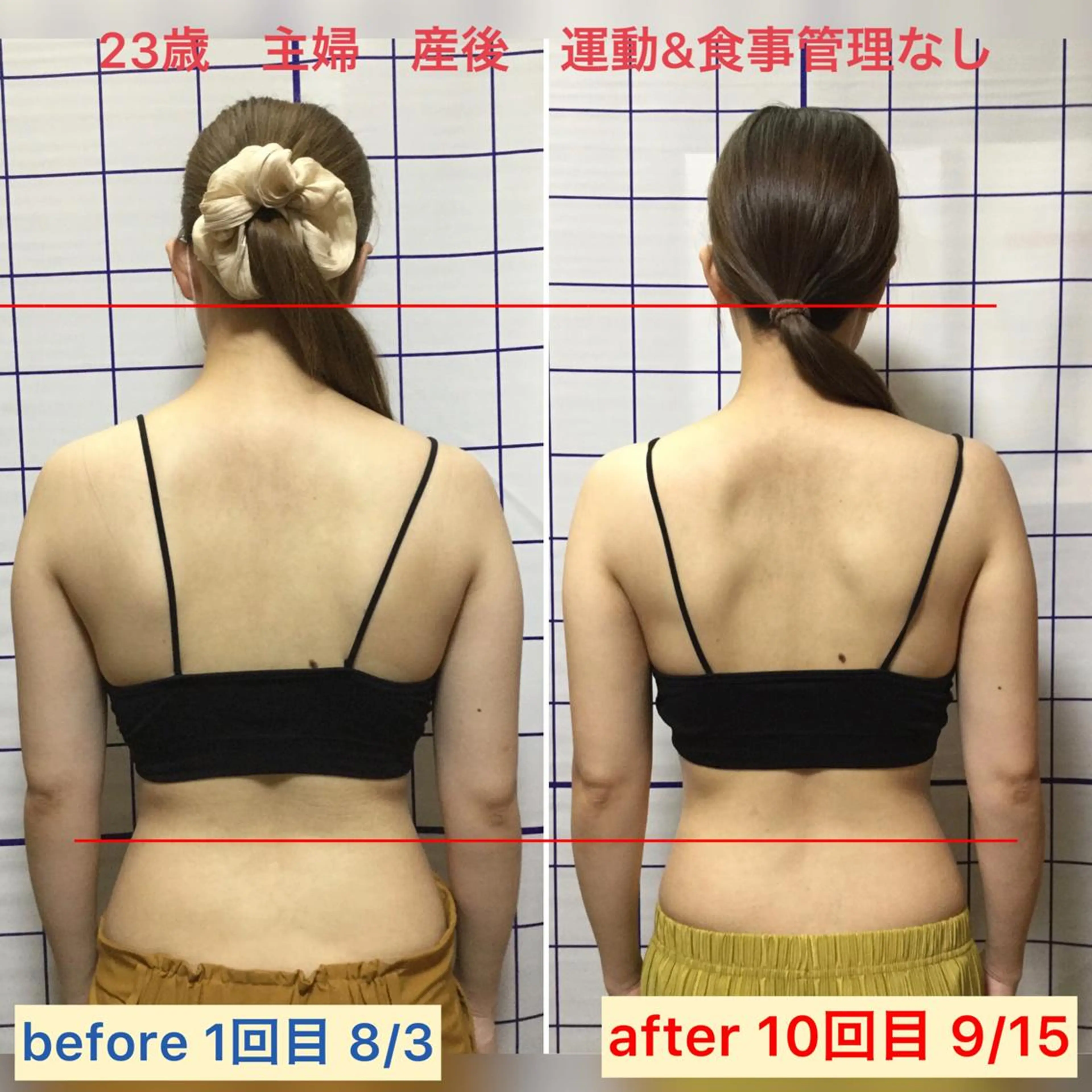 美背中エステ　天使の羽を出す　所要45分の写真