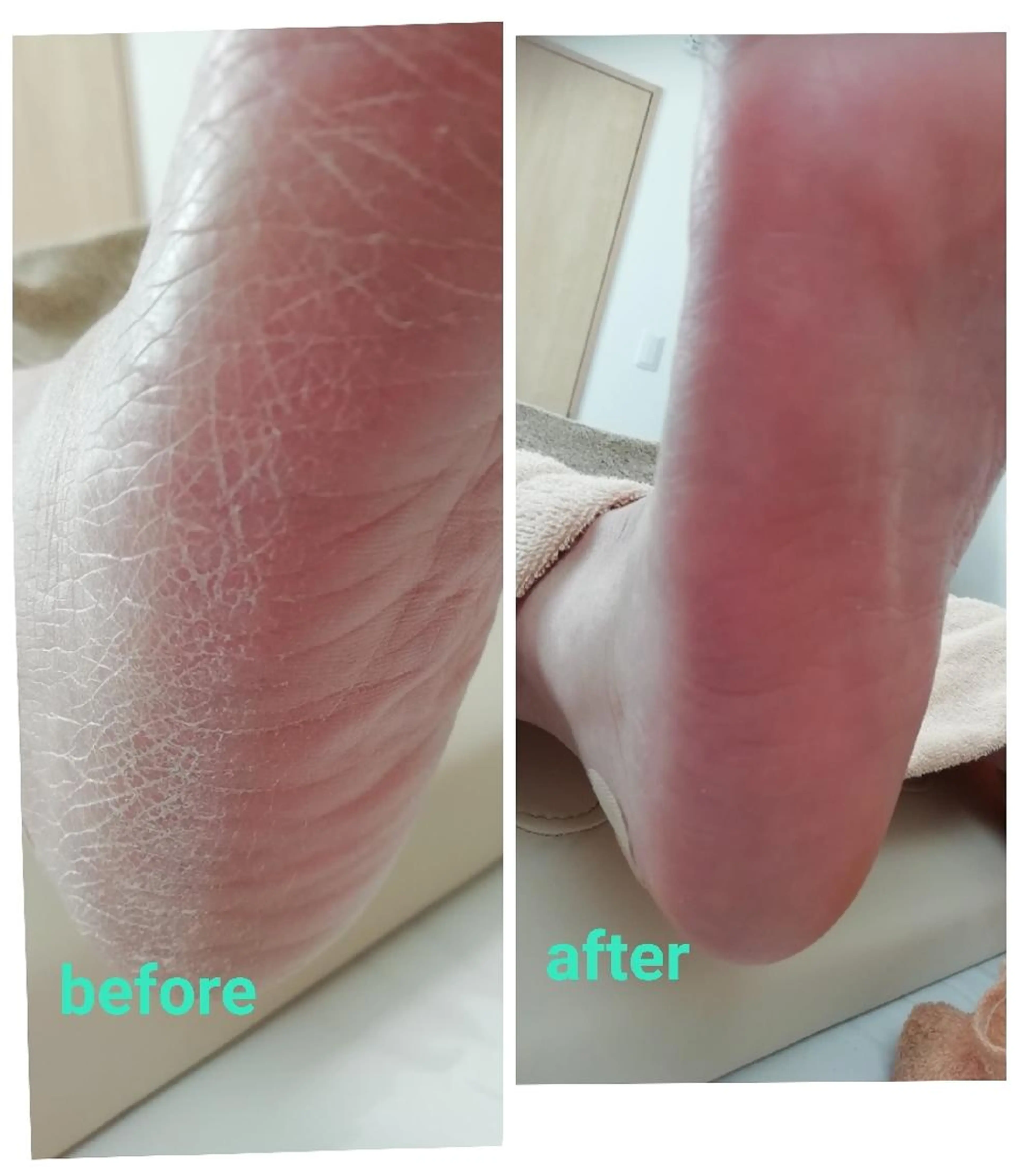 角質＋爪ケア60分の写真