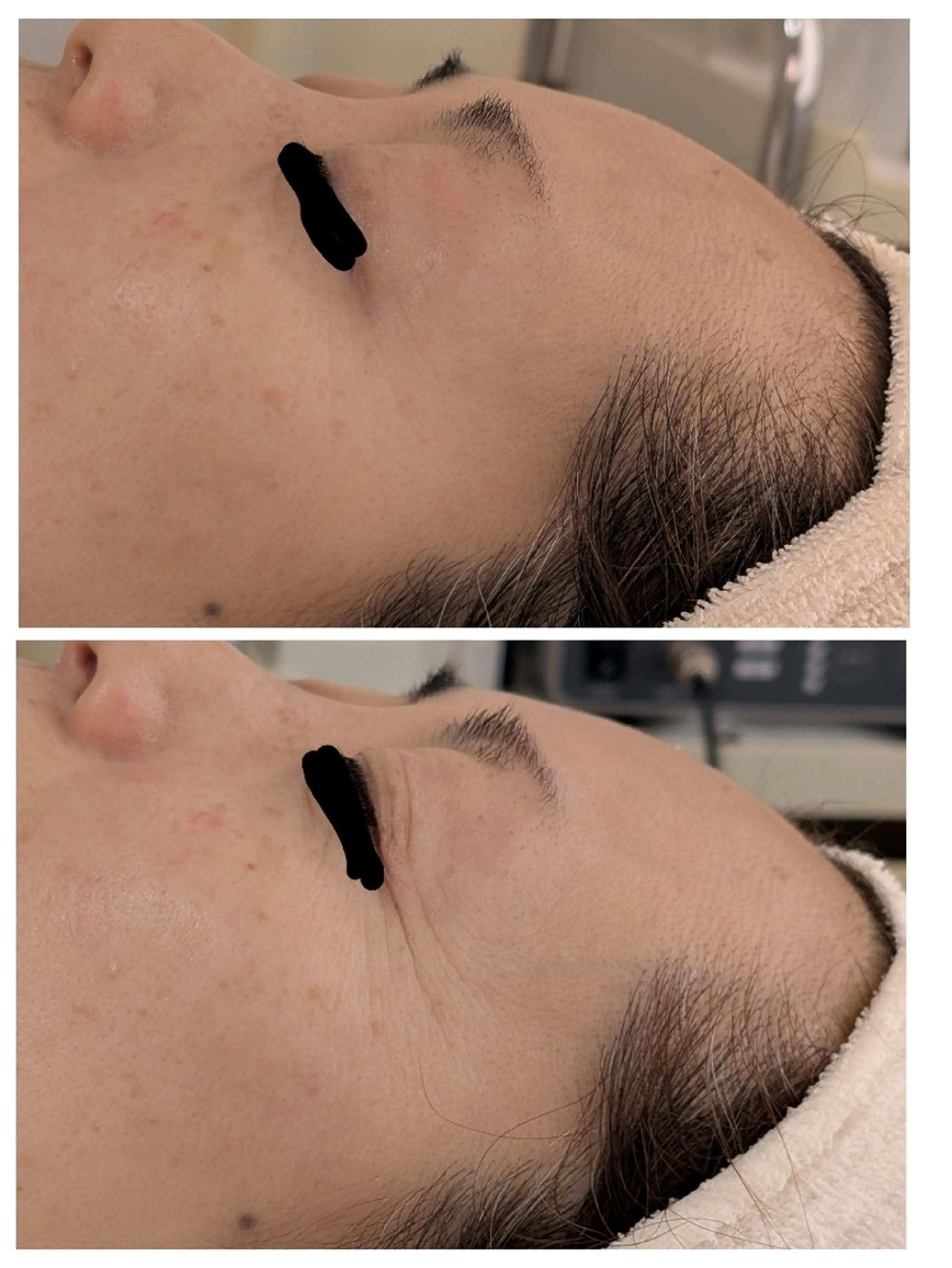 エステ 〈ニキビケアサロン〉 レゾン京橋店/ 浅川のエステ・リラクイメージ