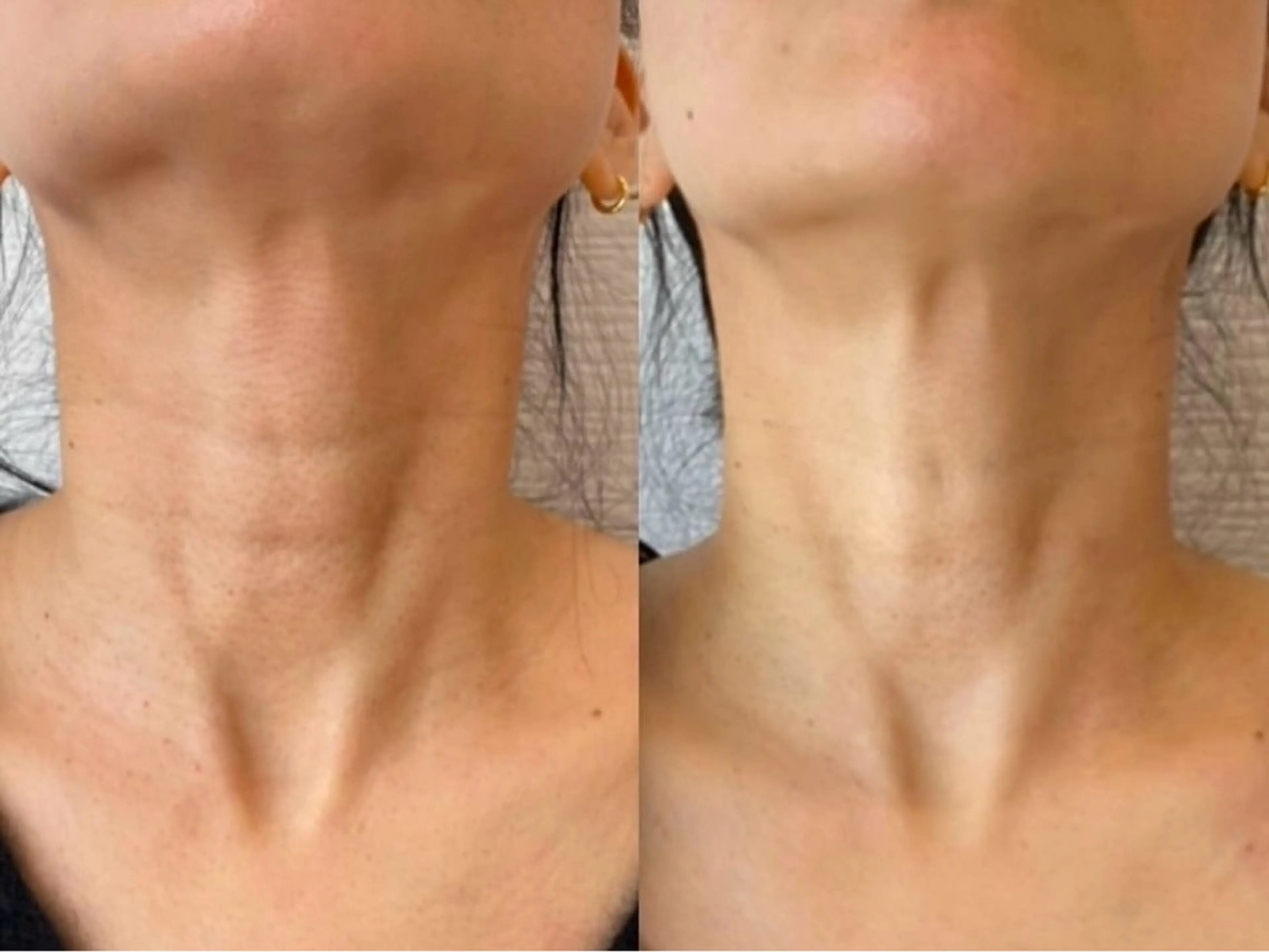 メンズ プライベートサロン アオラのネイルデザイン