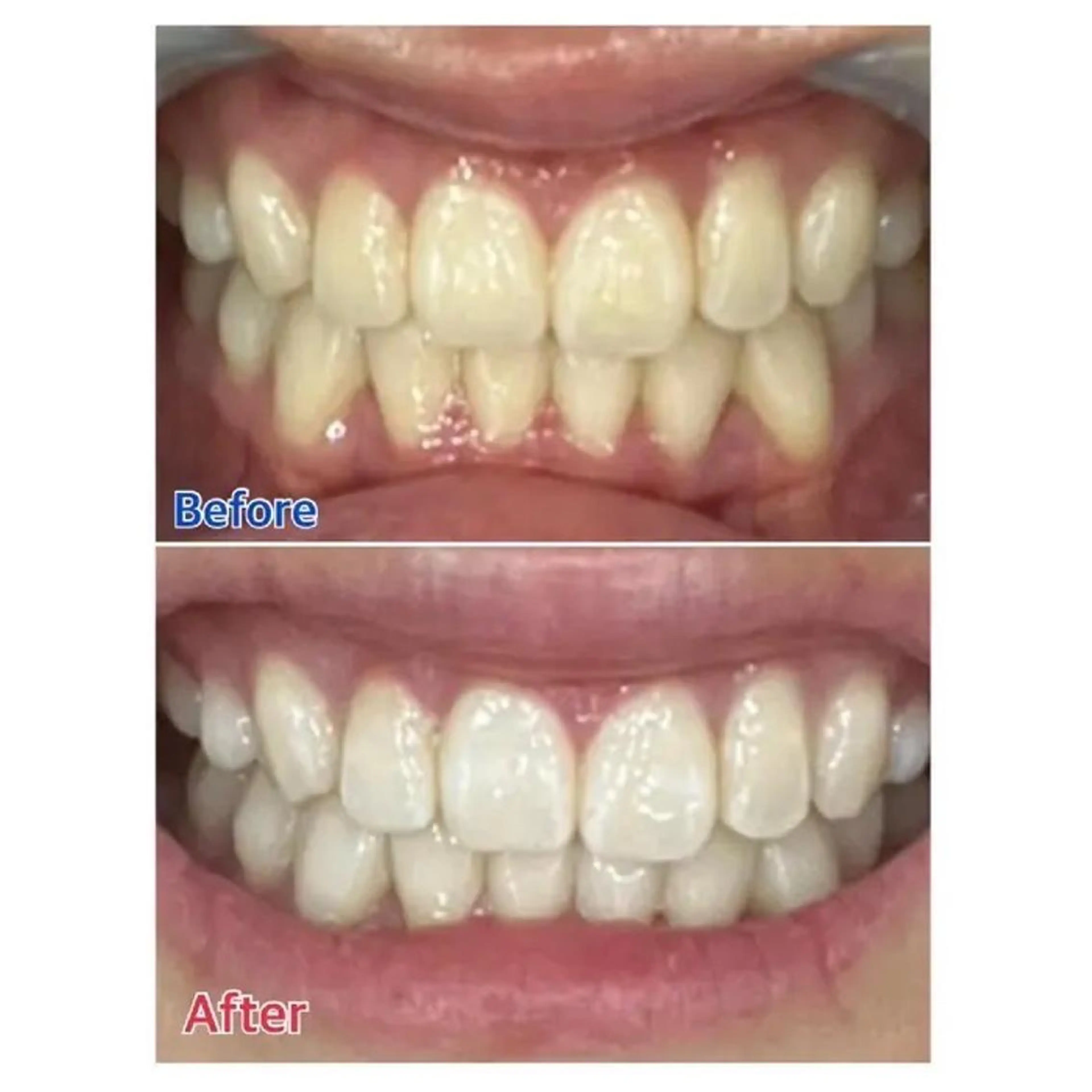 M渋谷 ホワイトニングのその他イメージ