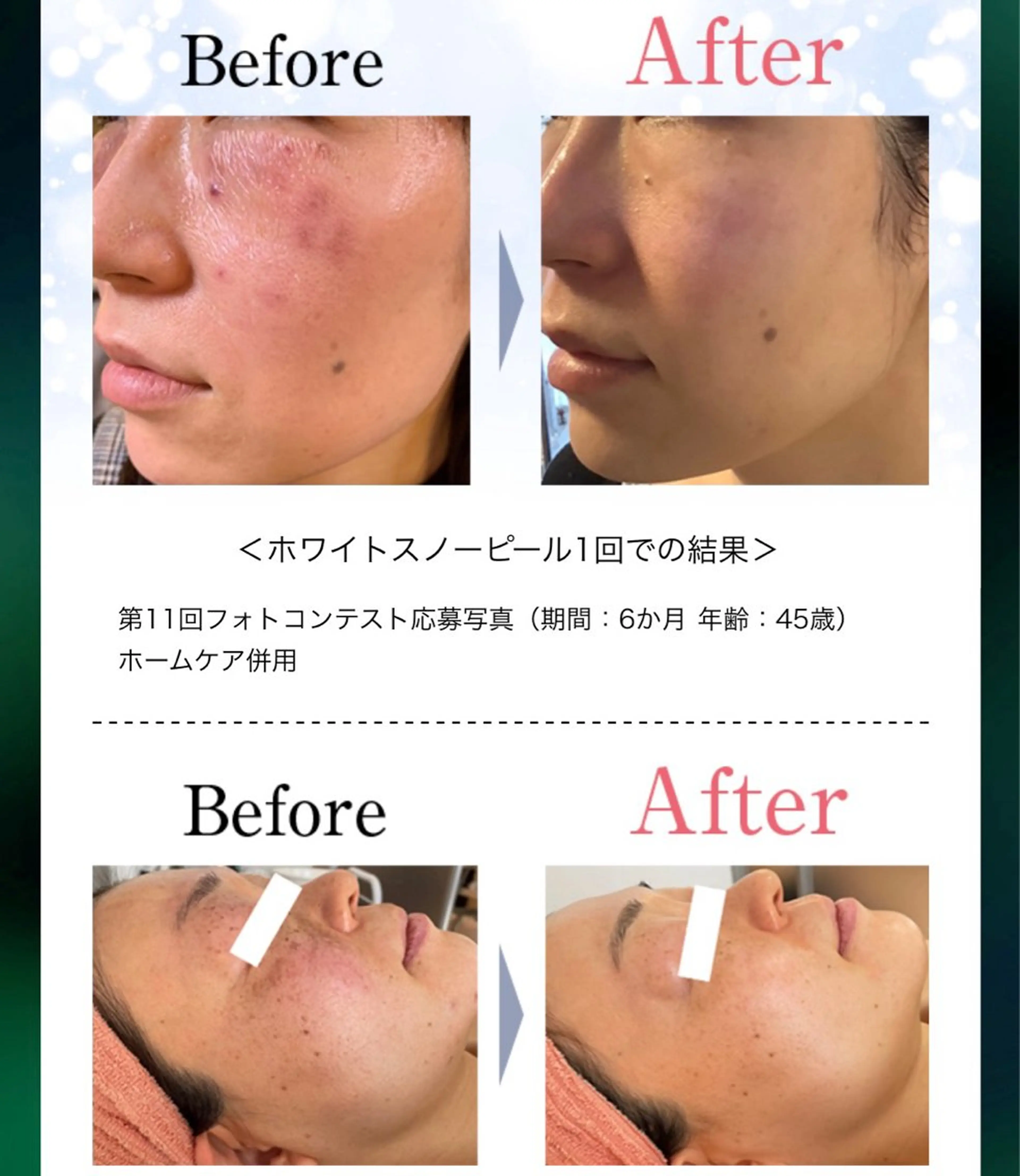 ティアラbyギャロ ティアラbyギャロのヘアスタイル