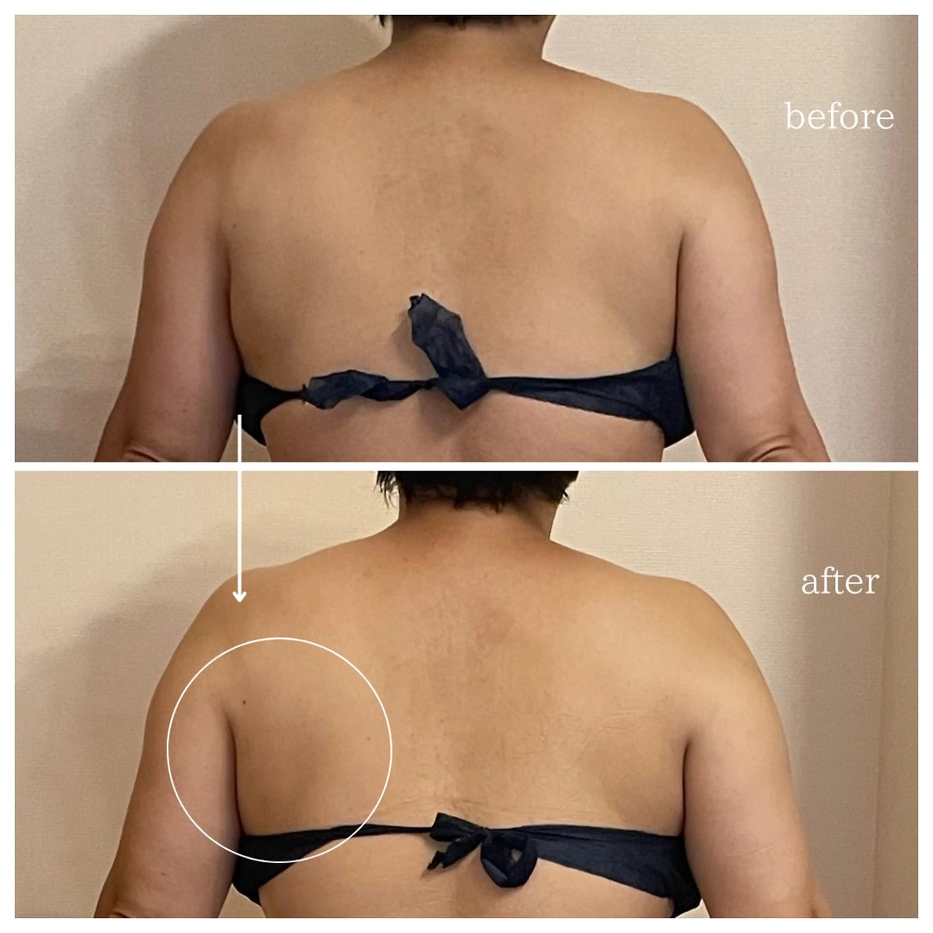 オフ:オン 全身筋膜マッサージのエステ・リラクイメージ