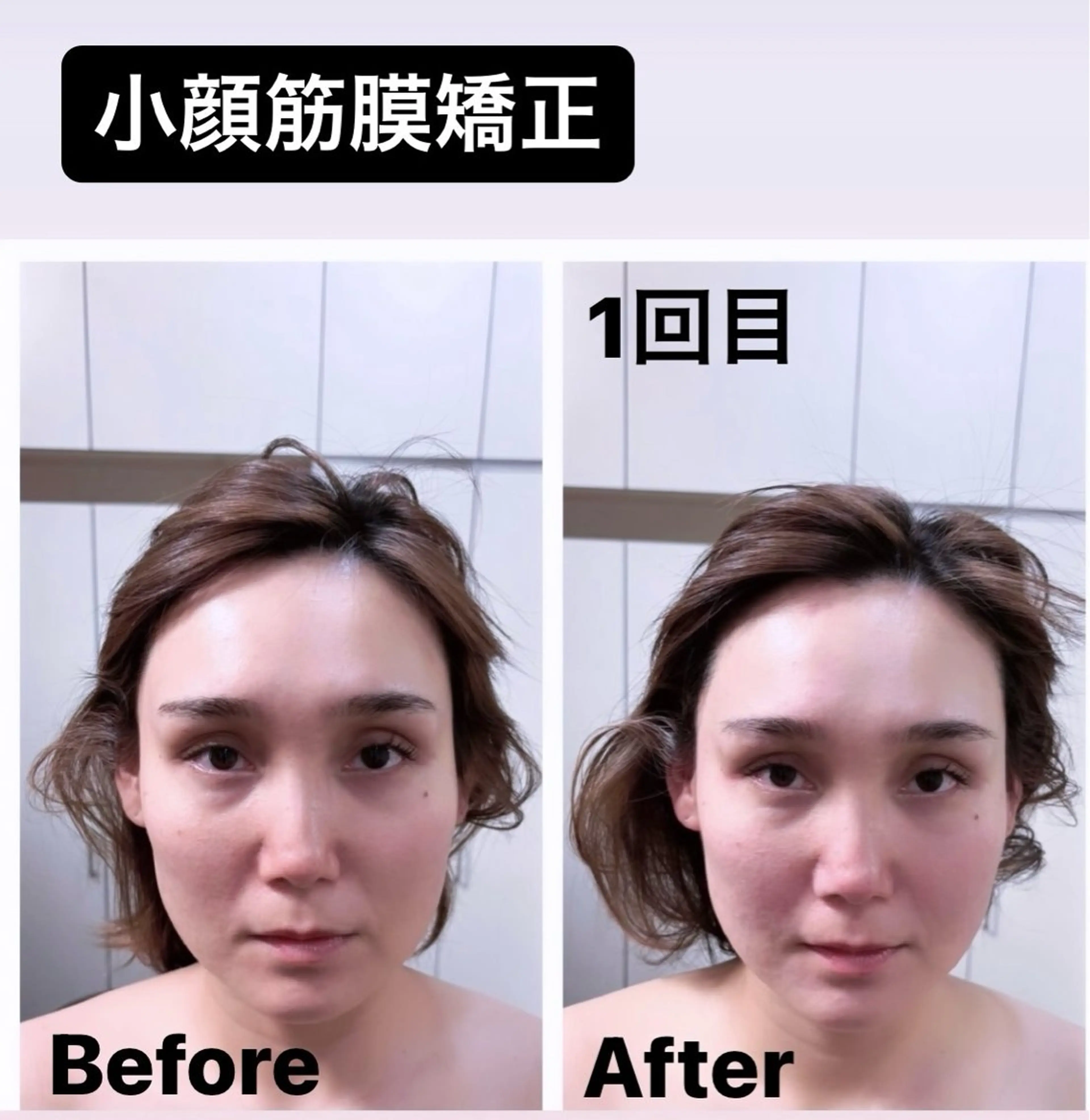 小顔筋膜矯正💆♀️パック付き⭐️の写真