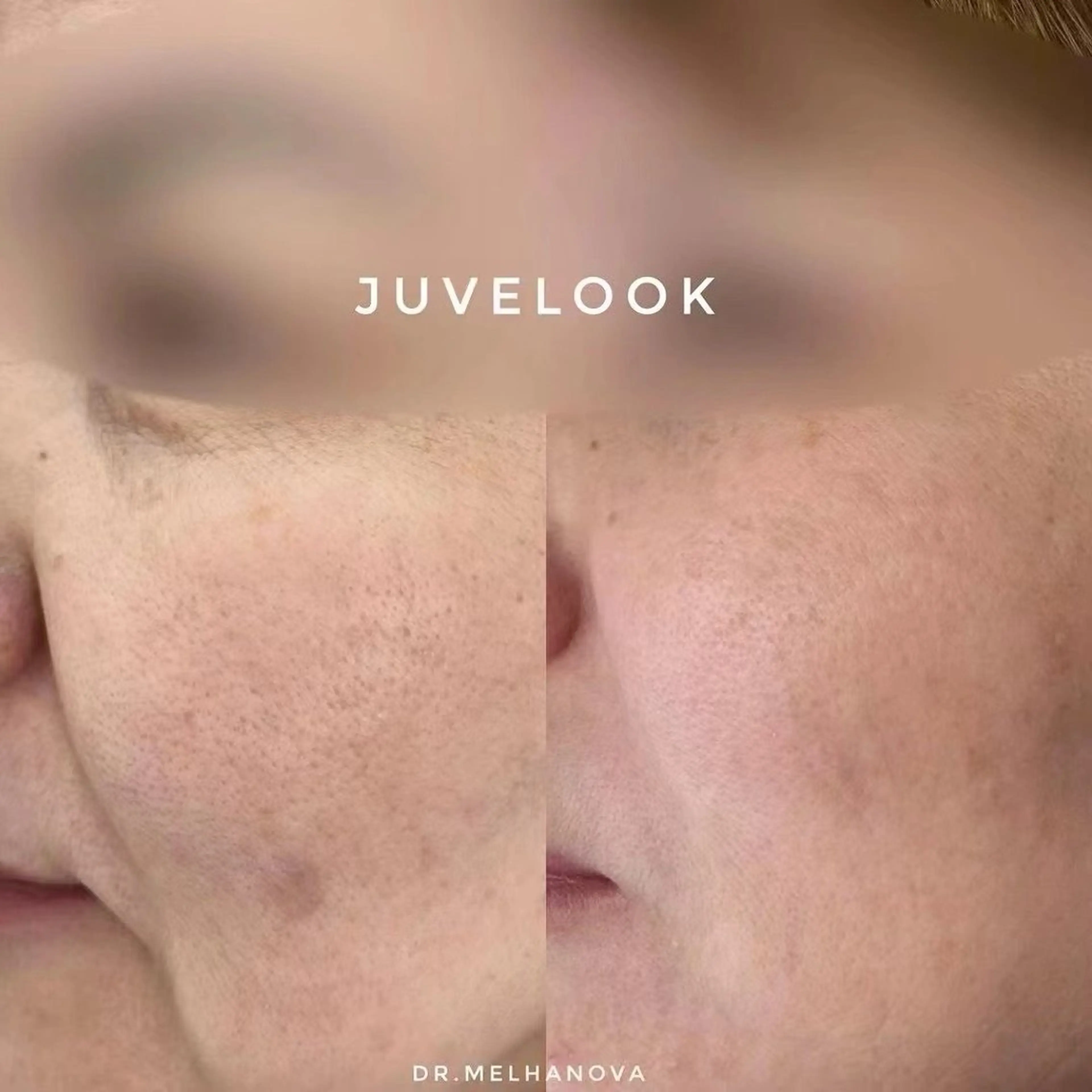 ネイル aliaハーブ水光店 エステティシャン募集のエステ・リラクイメージ