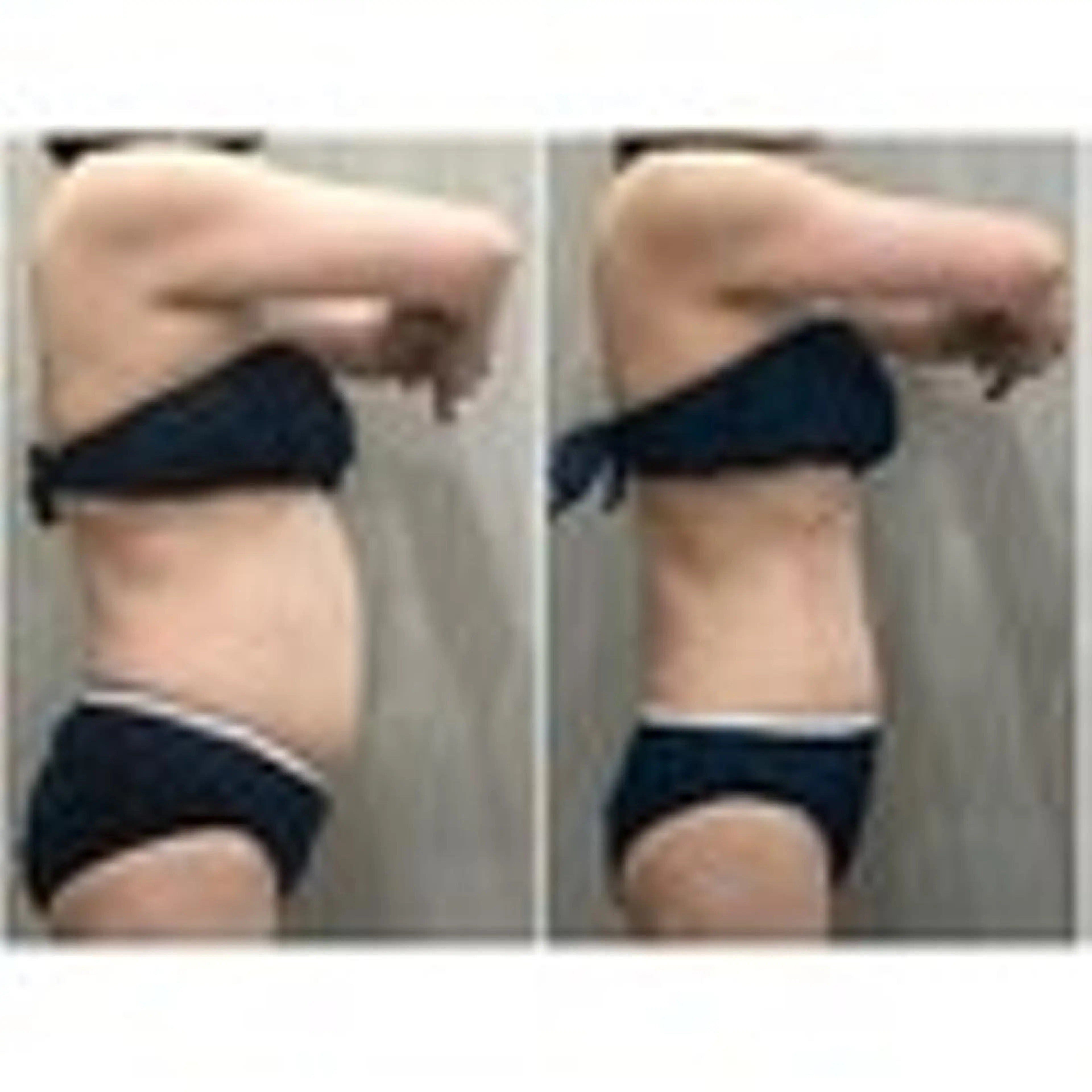 【本気痩身】人気NO.１ ♪40代くびれメイク！本気痩せ上半身集中痩身ケア60分の写真