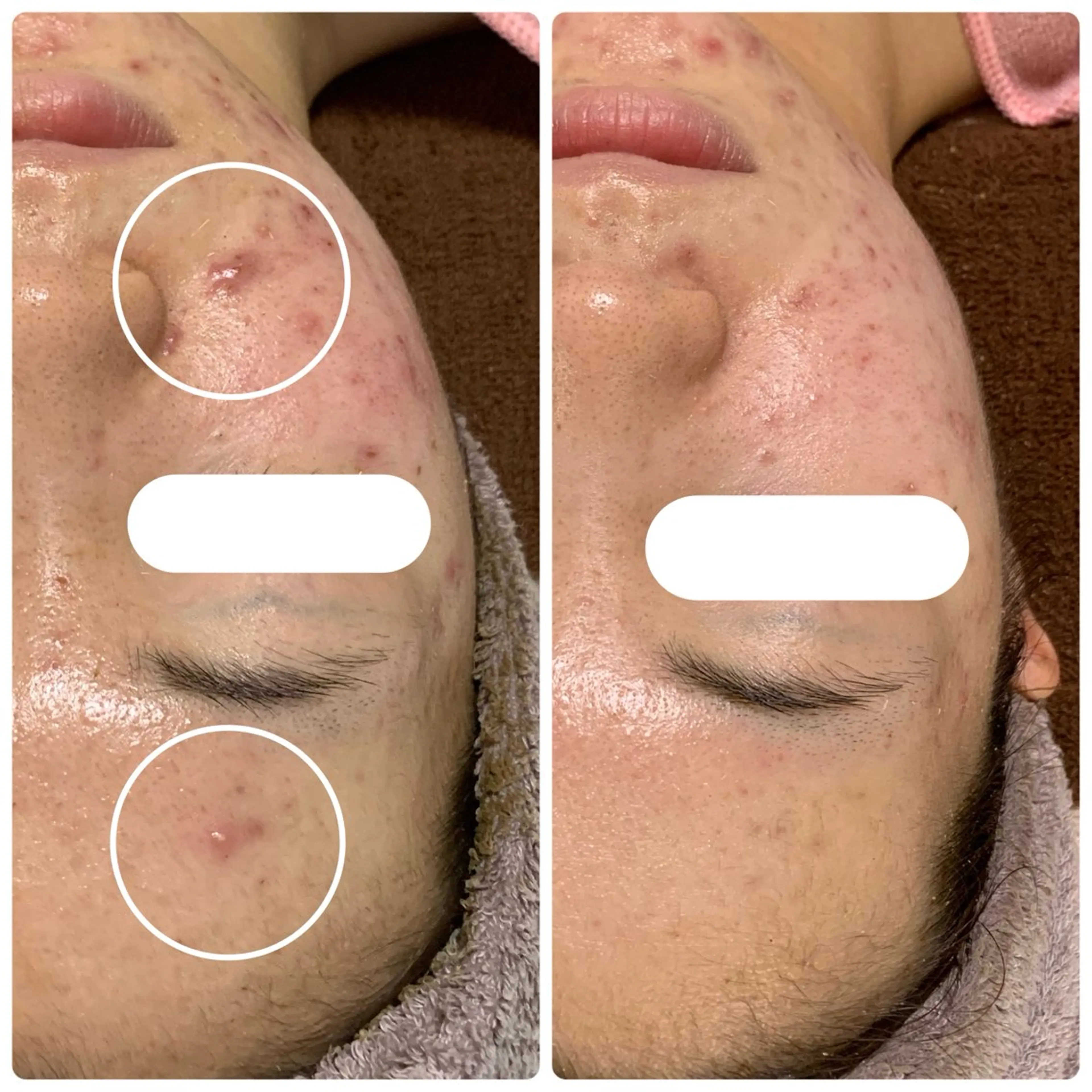 M.riche エムリシェのエステ・リラクイメージ