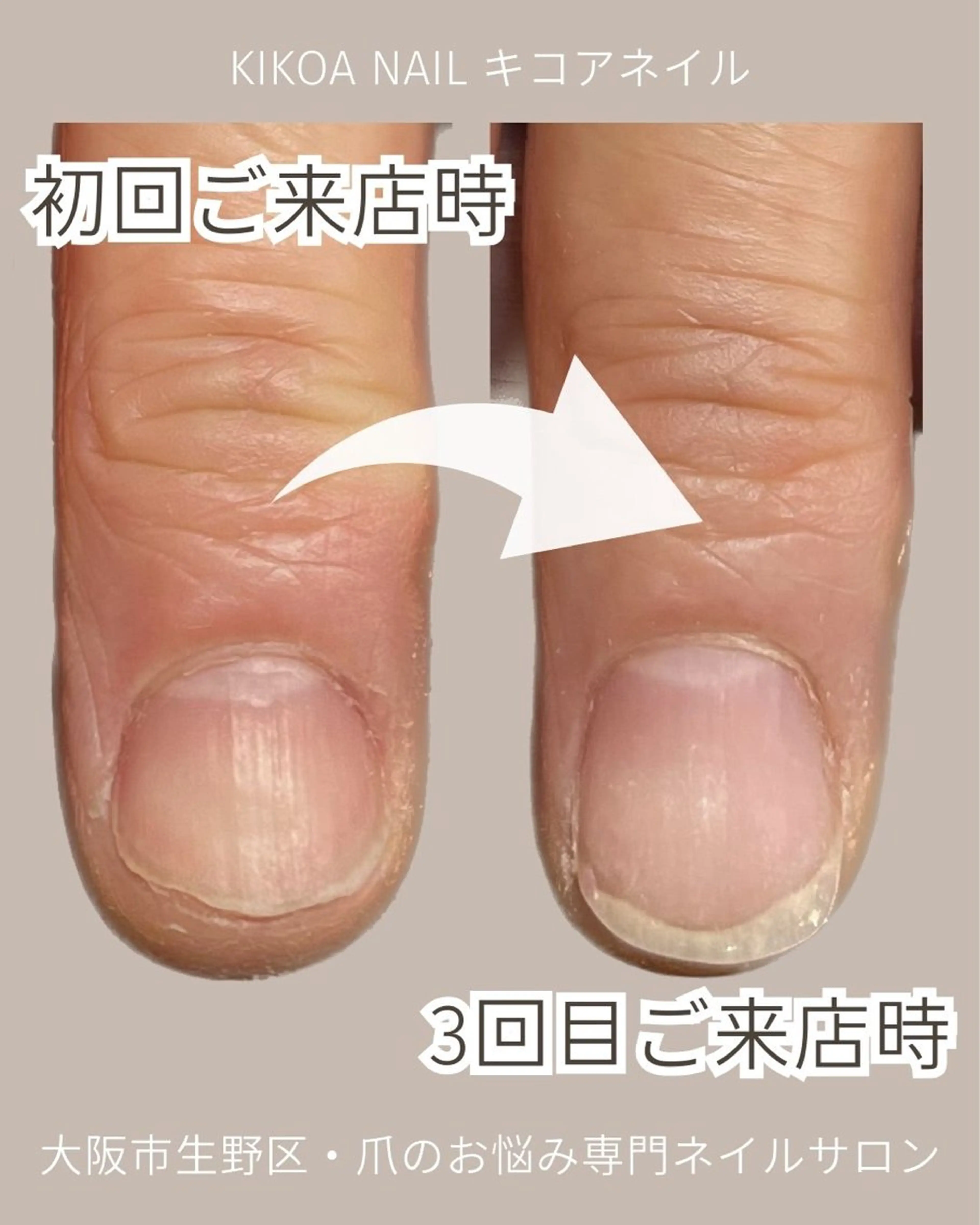 ネイル KIKOA NAIL キコアネイルのネイルデザイン