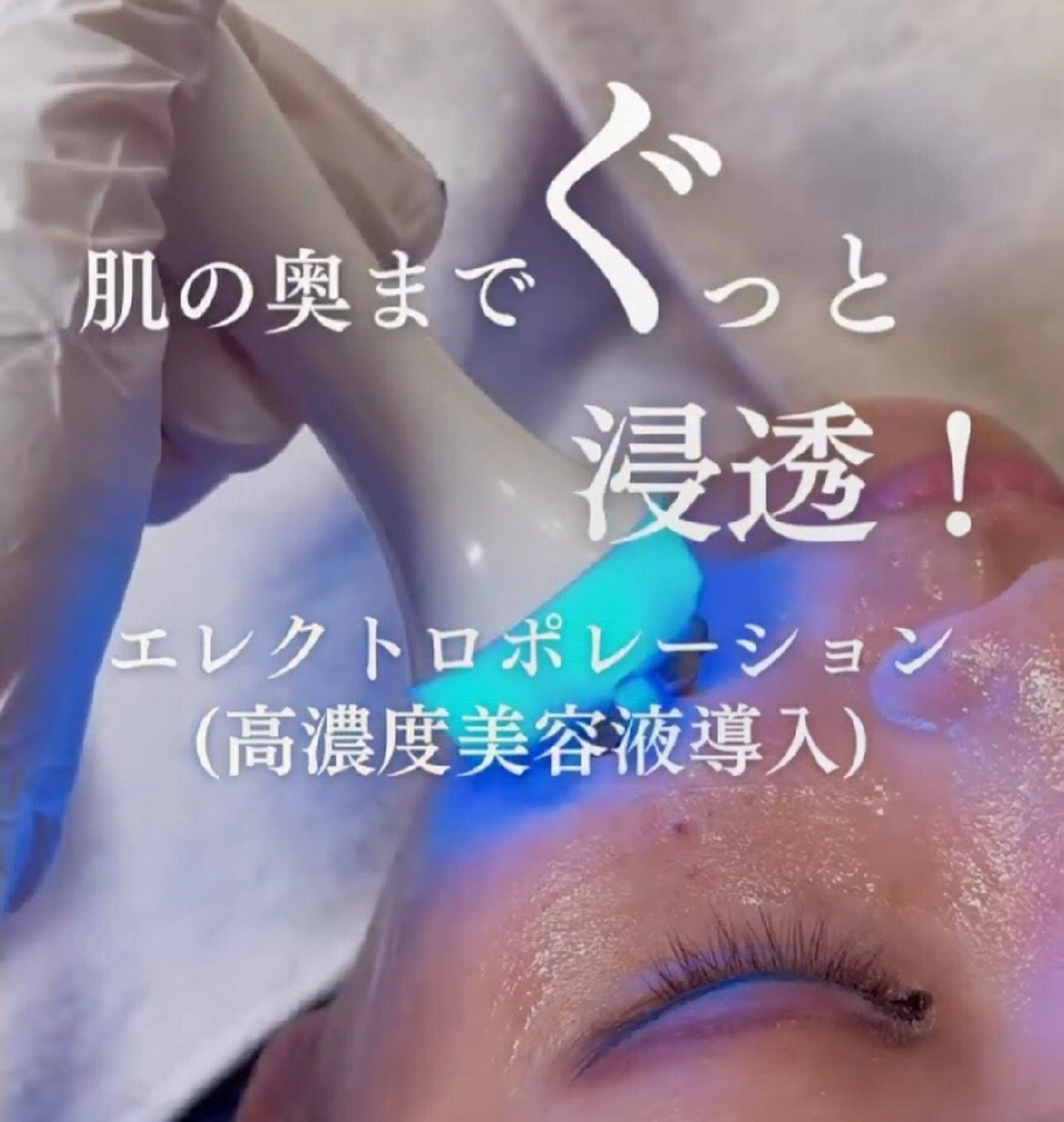 SPOT.com  シミケア専門店のエステ・リラクイメージ