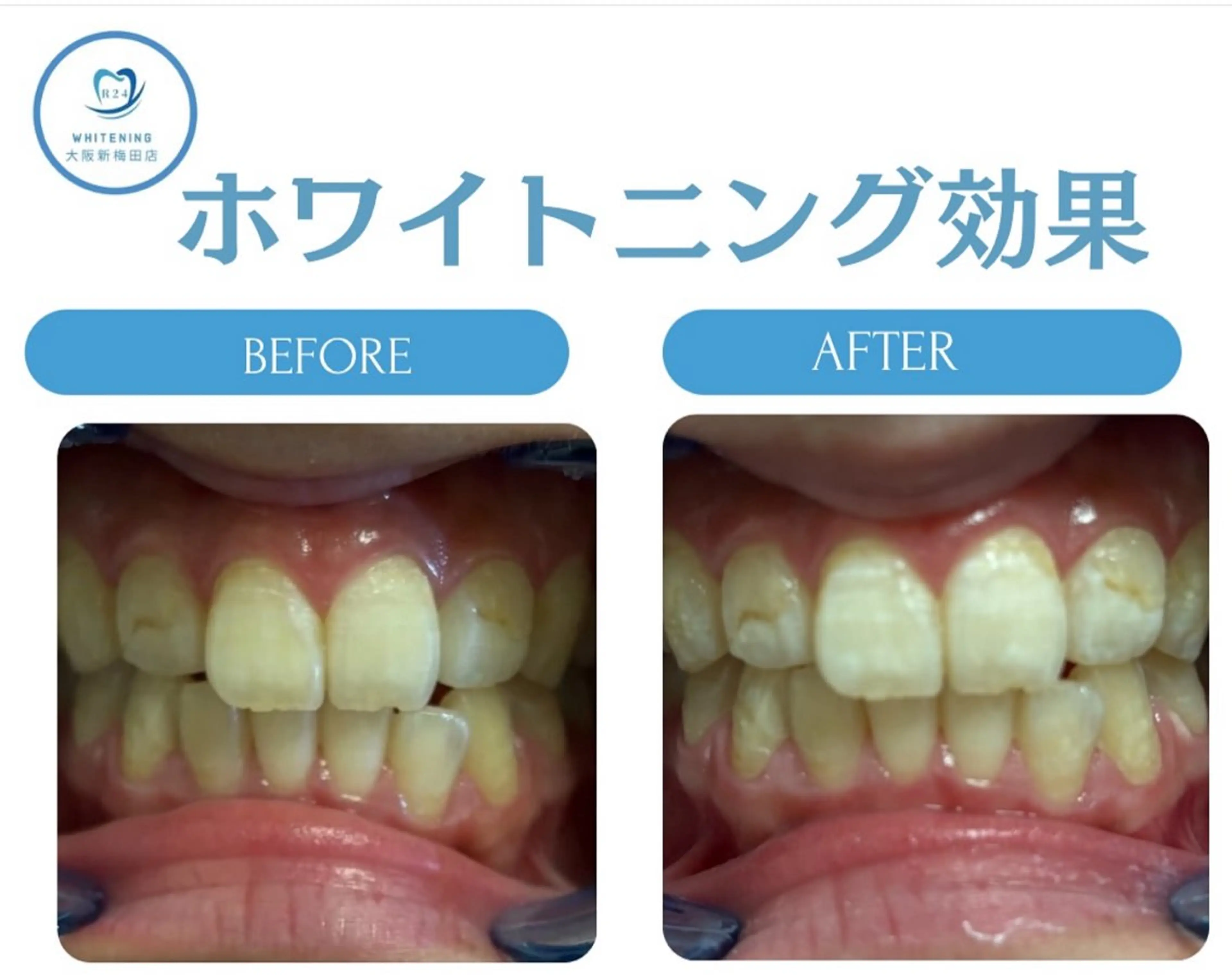 韓国式ホワイトニング R24大阪梅田店のその他イメージ