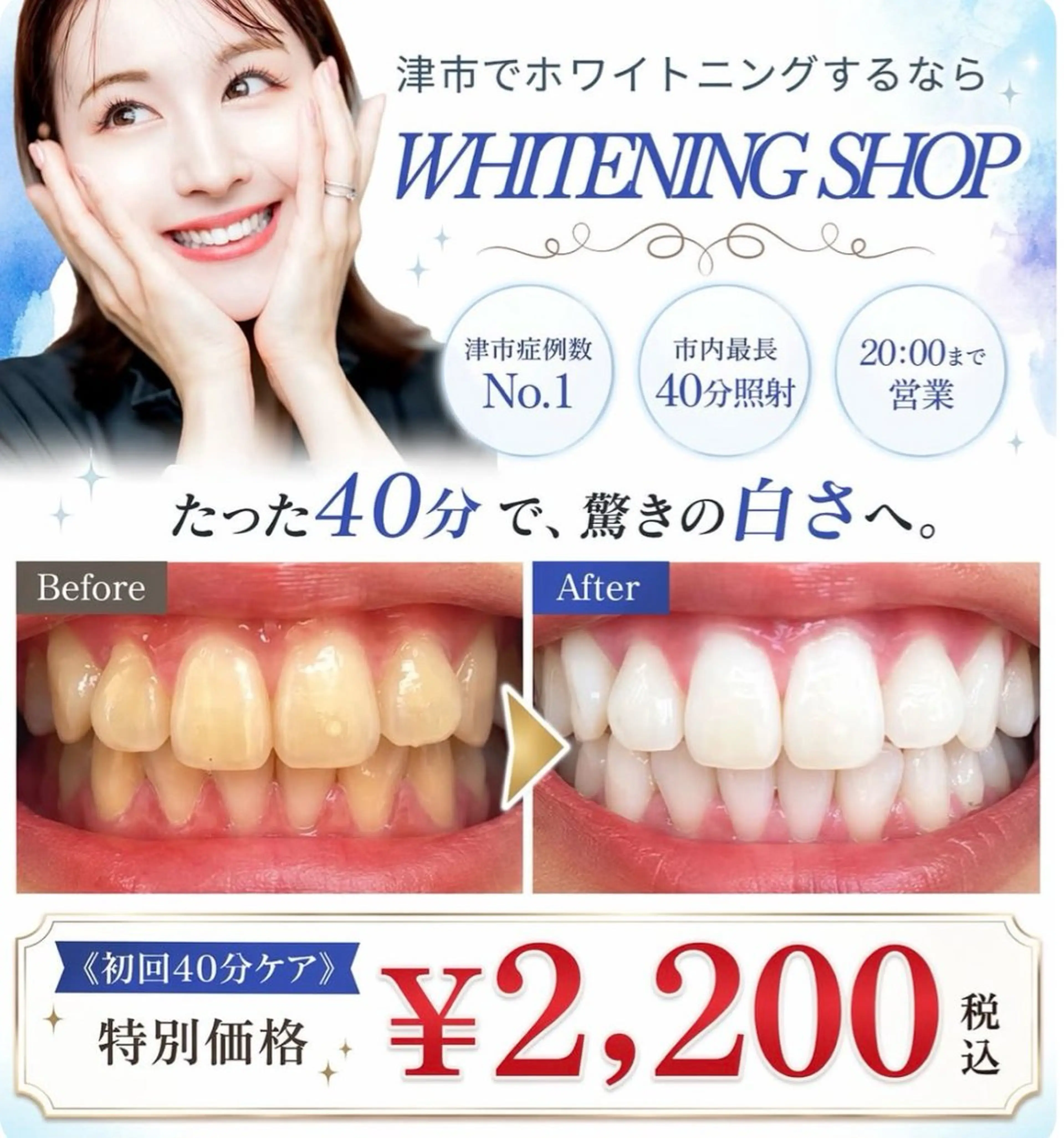 その他 ホワイトニング ショップ津店のその他イメージ