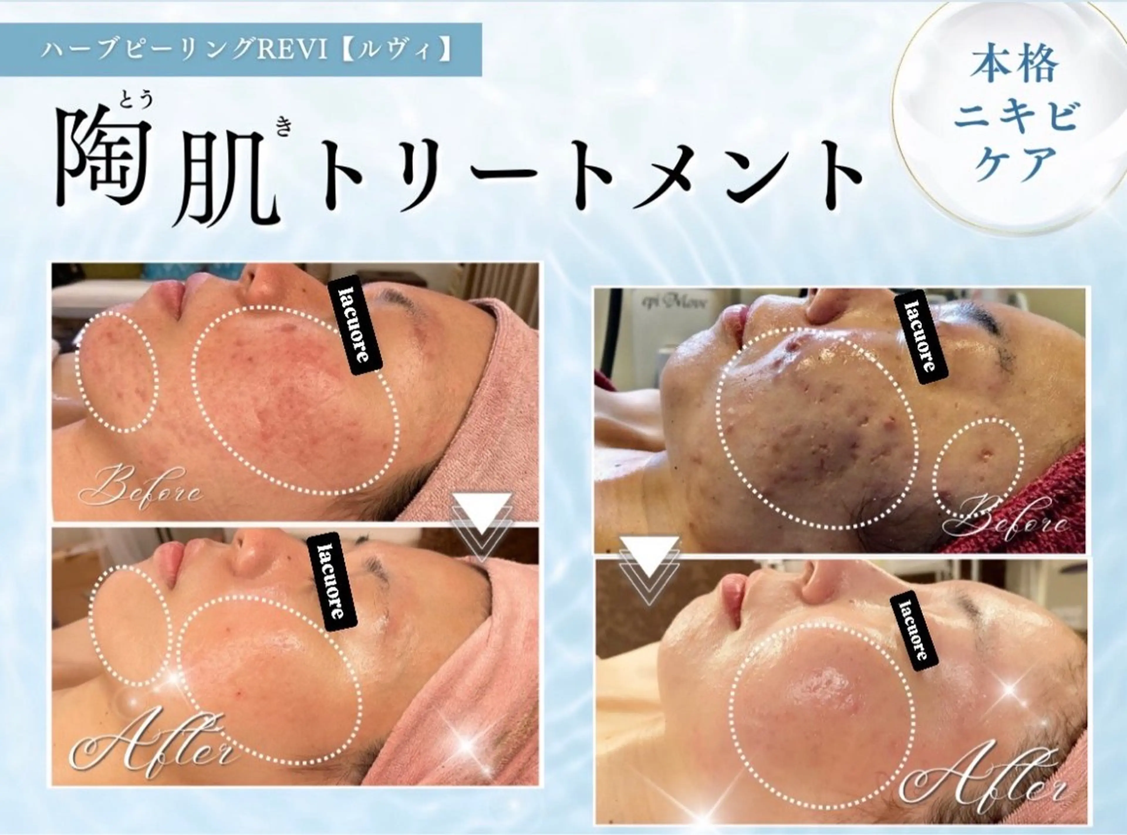 la   cuore所属・la   cuore 🌹ラ クオーレ🌹の眉毛・アイブロウイメージ