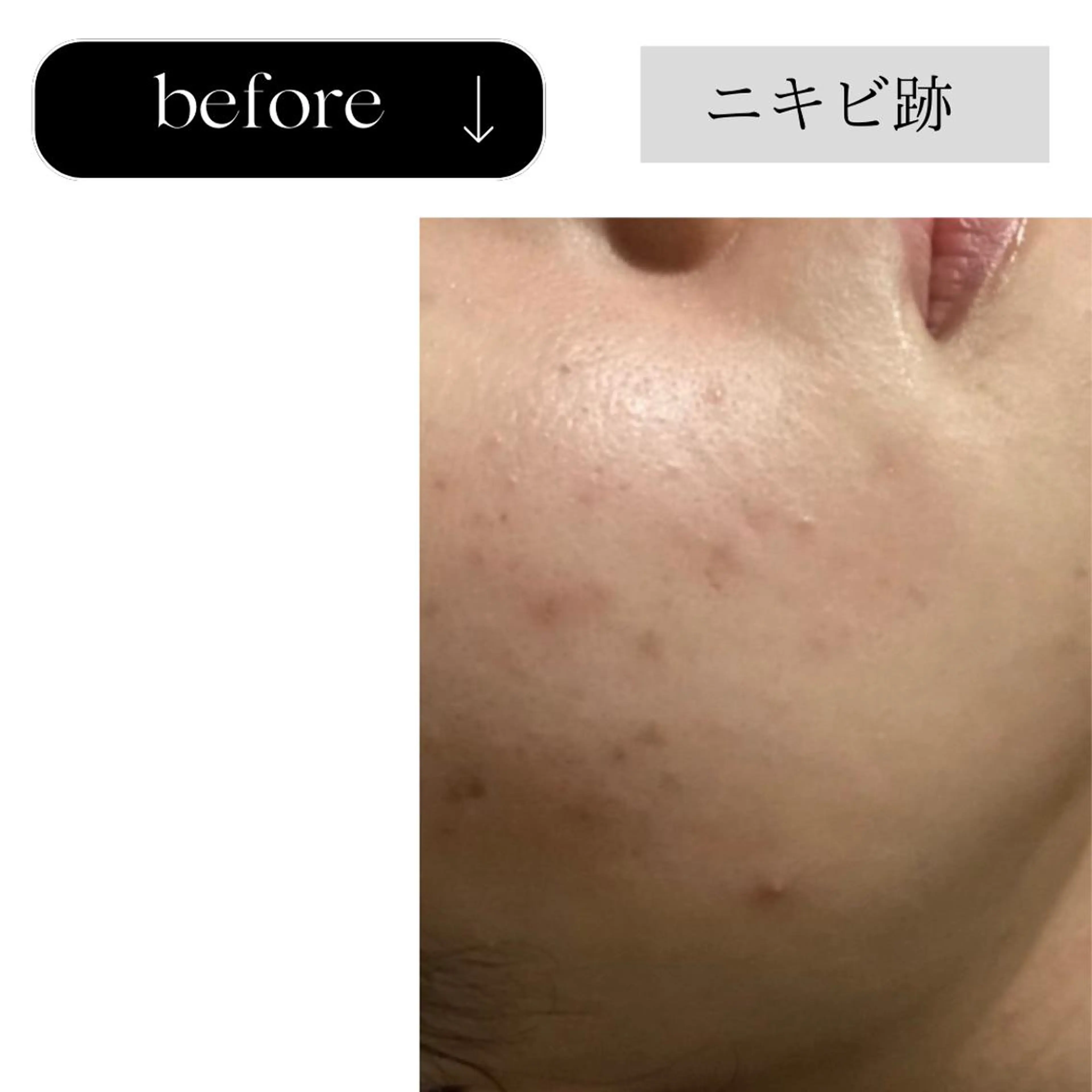 beauty CHOOSEのエステ・リラクイメージ